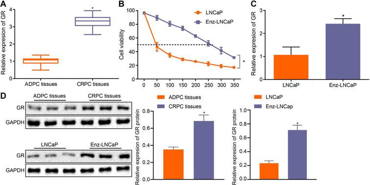 GR exhibits a high expression in CRPC. A, The expression of GR in CRPC and ADPC tissues determined by RT-qPCR, p*< 0.05, compared with ADPC tissues. B, The resistance of LNCaP cells to enzalutamide detected by CCK8 assay. C, The relative expression of GR in LNCaP and Enz-LNCaP cells determined by RT-qPCR. D, Grey value analysis and quantification of GR protein normalized to GAPDH in LNCaP and Enz-LNCaP cells as well as in the CRPC and ADPC tissues and LNCaP and Enz-LNCaP cells by Western blot analysis. p*< 0.05 compared with ADPC tissues or LNCaP cells. All the measurement data were expressed as mean ± standard deviation. Paired t-test (n= 8) was used to compare the paired data, and the unpaired t-test was used to compare the unpaired data that followed normal distribution and homogeneity of variance. Data of different groups at different time points were compared by repeated measures ANOVA with Bonferroni post hoc test. The cell experiment was repeated three times independently.