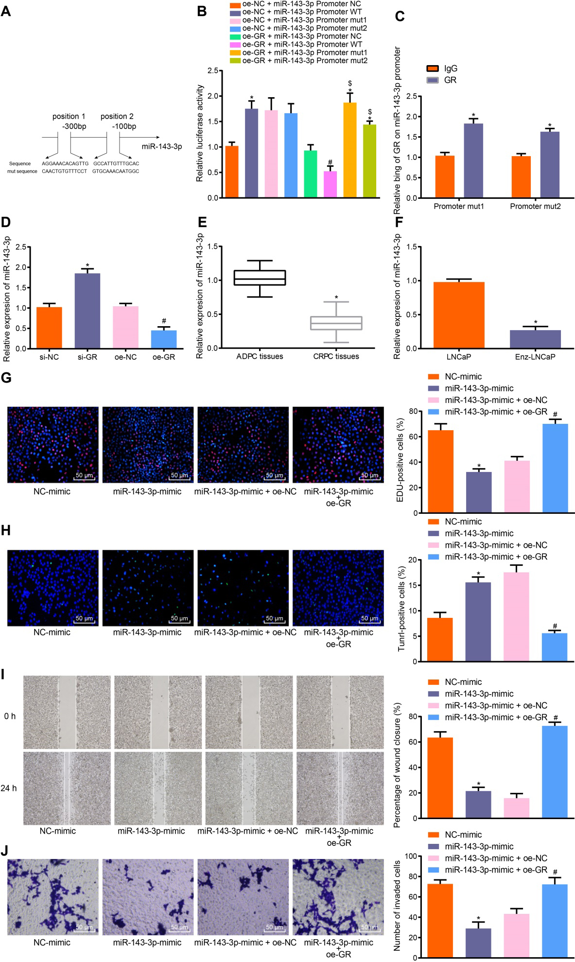 GR promotes the progression of CRPC in vitrovia suppression of miR-143-3p. A, The prediction of GR binding sites in miR-143-3p promoter and the mutation sequence produced by site mutations. B, The binding relationship between miR-143-3p and GR analyzed by dual-luciferase reporter assay, p*< 0.05 compared with the oe-NC + miR-143-3p Promoter NC group; p#< 0.05 compared with the oe-GR + miR-143-3p Promoter NC group; p$<0.05 compared with the oe-GR + miR-143-3p Promoter WT group. C, The enrichment of GR in miR-143-3p promoter detected by ChIP assay. p*< 0.05 compared with the IgG group. D, The expression of miR-143-3p after GR silencing or overexpression determined by RT-qPCR, p*< 0.05 compared with cells treated with si-NC; p#< 0.05 compared with cells treated with oe-NC. E, The expression of miR-143-3p in CRPC and ADPC tissues determined by RT-qPCR, p*< 0.05 compared with ADPC tissues. F. The expression of miR-143-3p in LNCaP and Enz-LNCaP cells determined by RT-qPCR, p*< 0.05 compared with LNCaP cells. G, Detection of cell proliferation by EdU assay, (200 ×, scale 50 μm), p*< 0.05 compared with cells treated with NC-mimic; p#< 0.05 compared with cells treated with miR-143-3p mimic and oe-NC. H, Detection of apoptosis by TUNEL assay (200 ×, scale 50 μm). p*< 0.05 compared with the NC-mimic group, p#< 0.05 compared with the miR-143-3p mimic + oe-NC group. I, The cell migration ability detected by wound healing assay. p*< 0.05 compared with the NC-mimic group; p#< 0.05 compared with the miR-143-3p mimic + oe-NC group. J, The invasive ability of cells detected by Transwell assay (200 ×, scale 50 μm), p*< 0.05 compared with the NC-mimic group, p#< 0.05 compared with the miR-143-3p-mimic + oe-NC group. Measurement data were expressed as mean ± standard deviation. Paired t-test (n= 8) was used to compare the data of the two groups of paired designs that followed normal distribution and homogeneity of variance, and the unpaired t-test was used to compare the data of the two groups of unpaired designs that followed normal distribution and homogeneity of variance. Data among multiple groups were analyzed by one-way ANOVA, followed by Tukey’s post hoc test. The cell experiment was repeated three times independently.