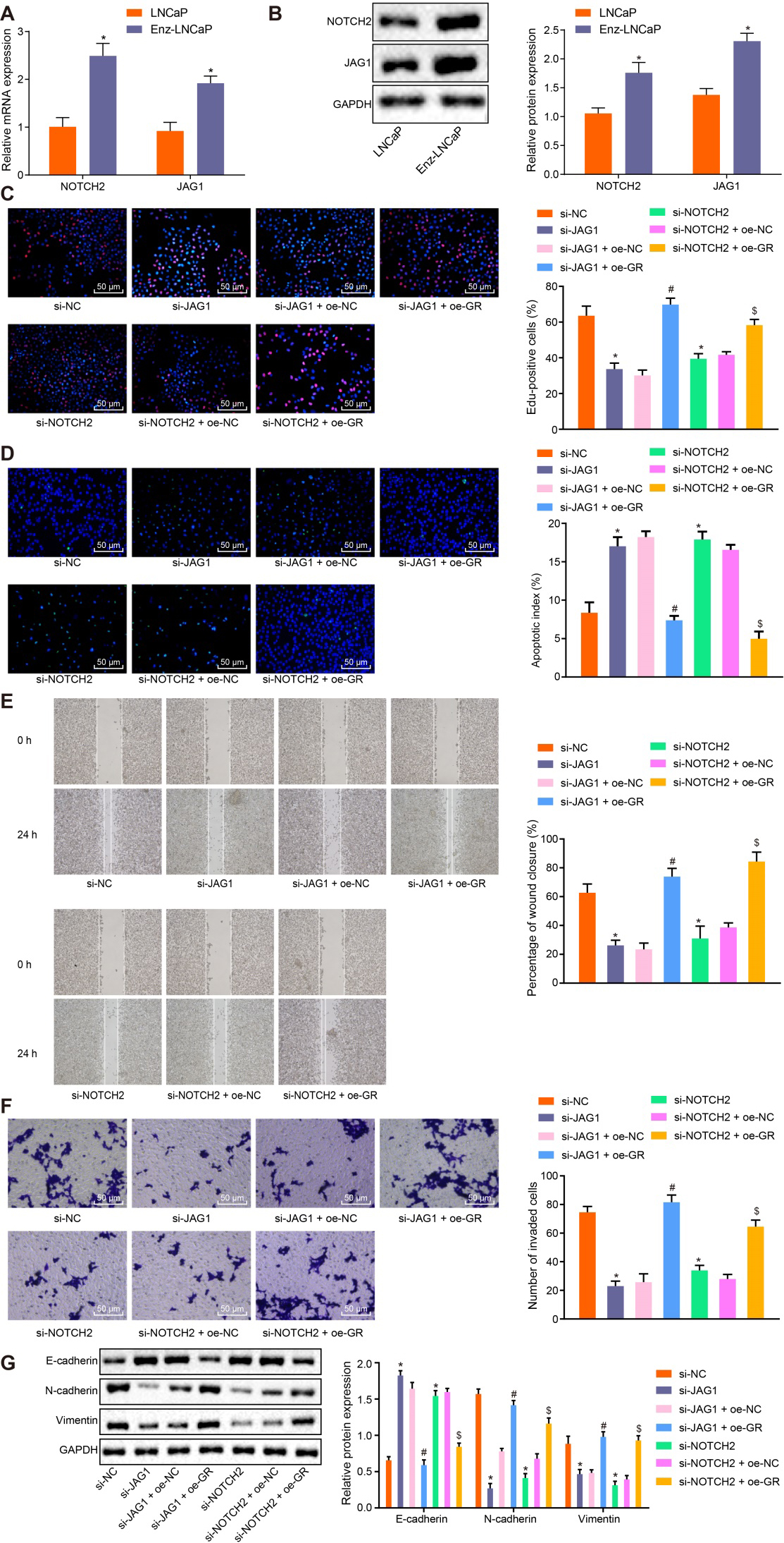 GR/miR-143-3p/JAG1/NOTCH2 axis involves in the progression of CRPC. A, The expression of JAG1/NOTCH2 in LNCaP and Enz-LNCaP cells determined by RT-qPCR, p*< 0.05 compared with LNCaP cells. B, Grey value analysis and quantification of JAG1/NOTCH2 protein normalized to GAPDH in LNCaP and Enz-LNCaP cells by Western blot analysis, p*< 0.05 compared with LNCaP cells. C, EdU assay was applied for detecting cell proliferation (200 ×, scale: 50 μm). D, TUNEL assay was conducted for detecting cell apoptosis (200 ×, scale: 50 μm). E, Detection of cell migration ability by wound healing assay. F, Detection of cell invasion ability by Transwell assay (200 ×, scale: 50 μm). G, Western blot analysis was performed to detect the protein expression of JAG1, NOTCH2, E-cadherin, N-cadherin and Vimentin normalized to GAPDH. In panel C, D, E, F, G, p*< 0.05 compared with cells treated with si-NC, p#< 0.05 compared with cells treated with si-JAG1 and oe-NC, p$< 0.05 compared with cells treated with si-NOTCH2 and oe-NC. The measurement data were expressed as mean ± standard deviation. The unpaired t-test was used to compare the data of the two groups of unpaired designs that followed normal distribution and homogeneity of variance. Data among multiple groups were analyzed by one-way ANOVA, followed by Tukey’s post hoc test. The cell experiment was repeated three times independently.