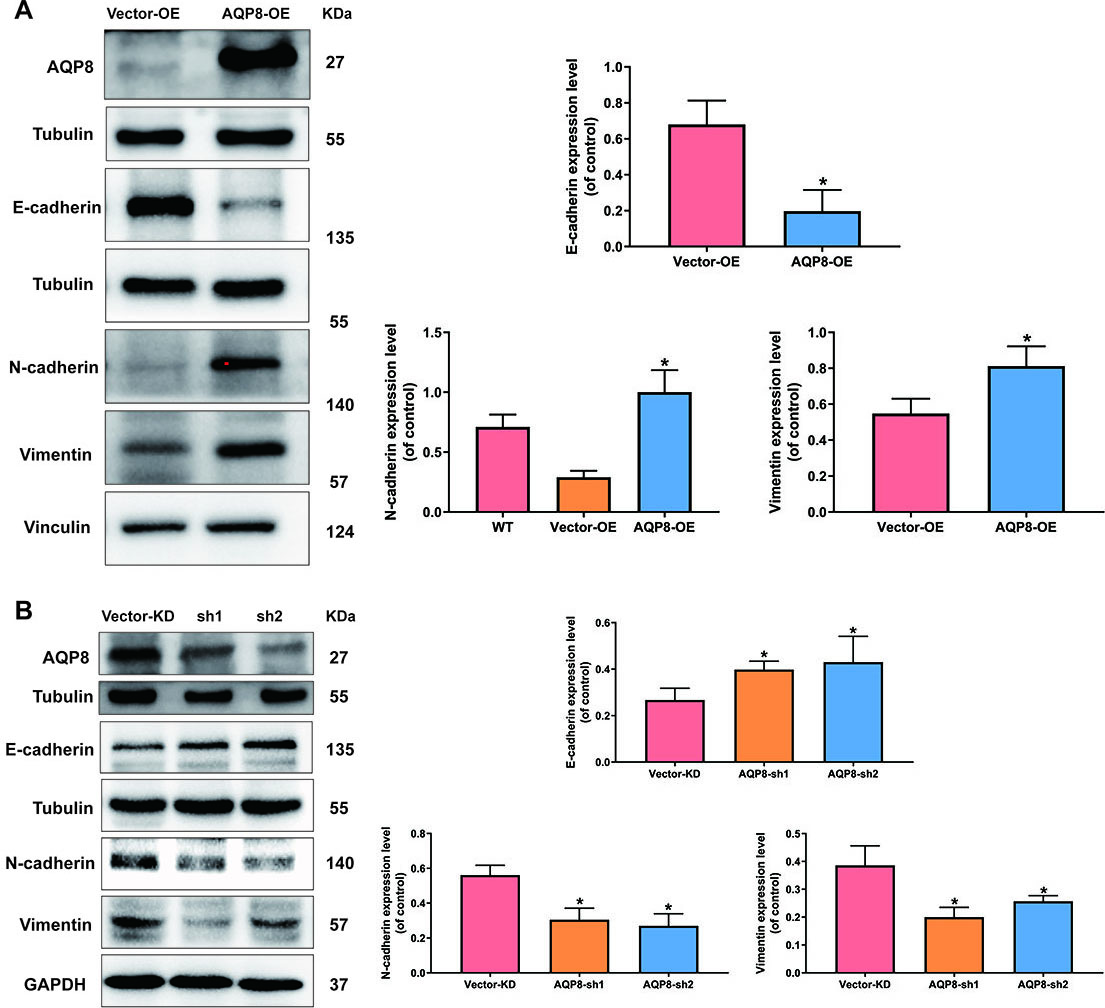 AQP8 induces expression of EMT-related markers in SiHa cells. A, Expression of E-cadherin, N-cadherin and vimentin in SiHa cells after AQP8 overexpression were identified by western blot analysis. B, Expression of E-cadherin, N-cadherin and Vimentin in SiHa cells after AQP8 knockdown were identified by western blot analysis. The data shown were the ratios of the E-cadherin/Tubulin, N-cadherin/Vinculin, N-cadherin/GAPDH, Vimentin/Vinculin or Vimentin/GAPDH. The data were shown as the means ±standard error of each group. Each experiment was performed three times. P*< 0.05 vs vector group.