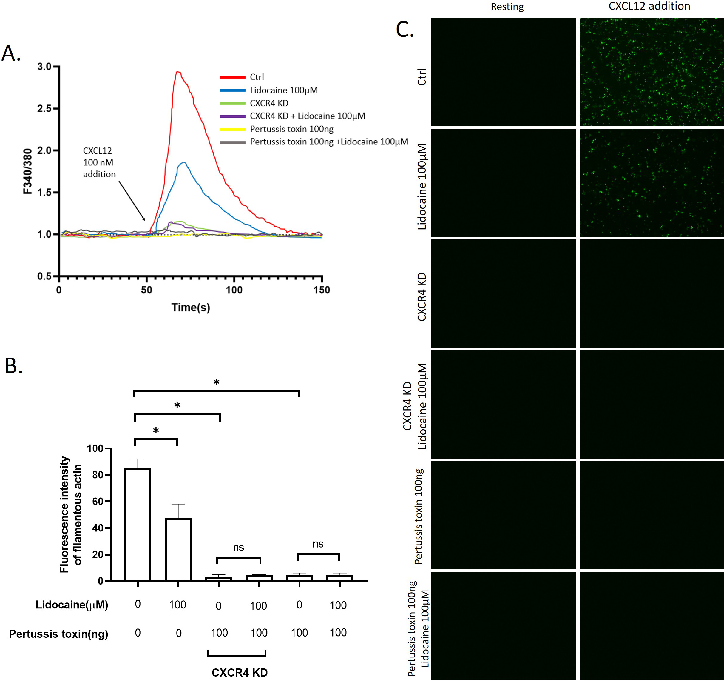 Effect of lidocaine on CXCL12-induced intracellular Ca2+ releasing and cytoskeleton remodeling. A. Real-time monitoring of the intracellular Ca2+ concentration in response to CXCL12 addition in A549 or CXCR4-knocked down A549 cells pre-incubated with testing reagents for 2 hours. B. Fluorescence intensity of filamentous actin before and after the exposure of CXCL12. The data were displayed in the Relative Fluorescence Unit C. Representative images of fluorescence of filamentous actin. (Significant differences are indicated by p*< 0.01, NS = not significant).