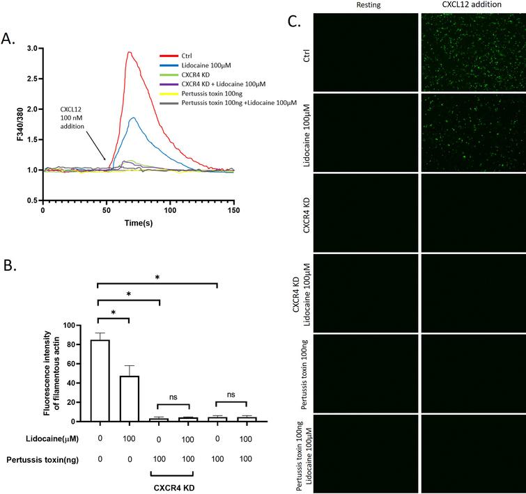 Effect of lidocaine on CXCL12-induced intracellular Ca2+ releasing and cytoskeleton remodeling. A. Real-time monitoring of the intracellular Ca2+ concentration in response to CXCL12 addition in A549 or CXCR4-knocked down A549 cells pre-incubated with testing reagents for 2 hours. B. Fluorescence intensity of filamentous actin before and after the exposure of CXCL12. The data were displayed in the Relative Fluorescence Unit C. Representative images of fluorescence of filamentous actin. (Significant differences are indicated by p*< 0.01, NS = not significant).