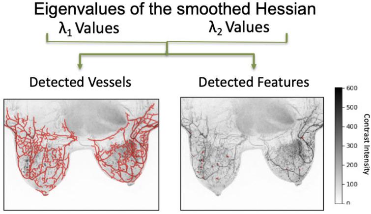 Qualifying vascularity in breast tissue; eigenvalues demonstrate the detection of vessels and features in breast image samples.