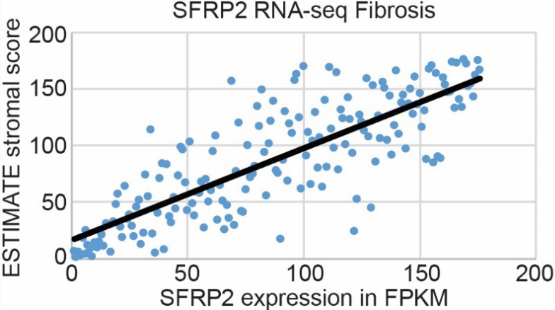 SFRP2 RNA expression is associated with fibrosis in pancreatic cancer. mRNA expression of SFRP2 in pancreatic cancer patient samples from the TCGA (n= 176, consisting of 95 men, 80 women, and 1 unknown) correlates with the ESTIMATE stromal score obtained from RNAseq data on those patients. Spearman correlation coefficient is 0.81.