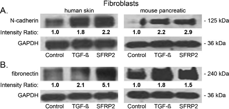 SFRP2 induces epithelial mesenchymal transformation and collagen production in fibroblasts. (A) Human skin and mouse pancreatic fibroblasts were either untreated (control) or treated for 48 hours with SFRP2 (30 nM) or TGFβ (5 nM), and protein levels were analyzed by western blot. Band densities (average intensity x band surface) were normalized to the loading control, GAPDH, to eliminate inter-sample variability. Results were normalized to the untreated control and presented as intensity ratio. (A, B) TGFβ and SFRP2 treatments induce an increase of N-cadherin (A) and fibronectin (B) protein levels in both human skin and mouse pancreatic fibroblasts.