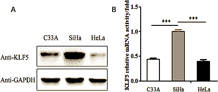 The expression of KLF5 gene in the C33A, SiHa and HeLa cell lines. (A) Western blot analysis of the endogenous KLF5 protein expression level in the C33A, SiHa and HeLa cell lines. (B) Real-time PCR showing the KLF5 gene mRNA expression levels in the C33A, SiHa and HeLa cell lines.