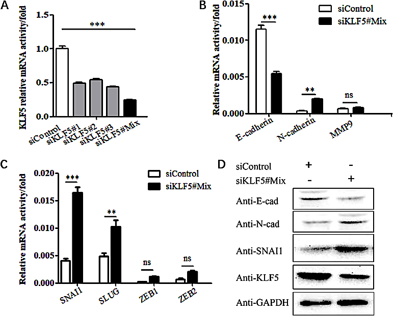 The effect of silencing the KLF5 gene on the EMT phenotype in SiHa cells. (A) The efficacy of KLF5 silencing as validated by real-time PCR. (B) Real-time PCR showing the effect of KLF5 knockdown on the mRNA levels of E-cadherin, N-cadherin and MMP9 in SiHa cells. (C) Real-time PCR showing the effect of KLF5 knockdown on the mRNA levels of SNAI1, SLUG, ZEB1 and ZEB2 in SiHa cells. (D) Western blot analysis of the effect of silencing KLF5 on the protein expression levels of E-cadherin, N-cadherin and SNAI1 in SiHa cells.