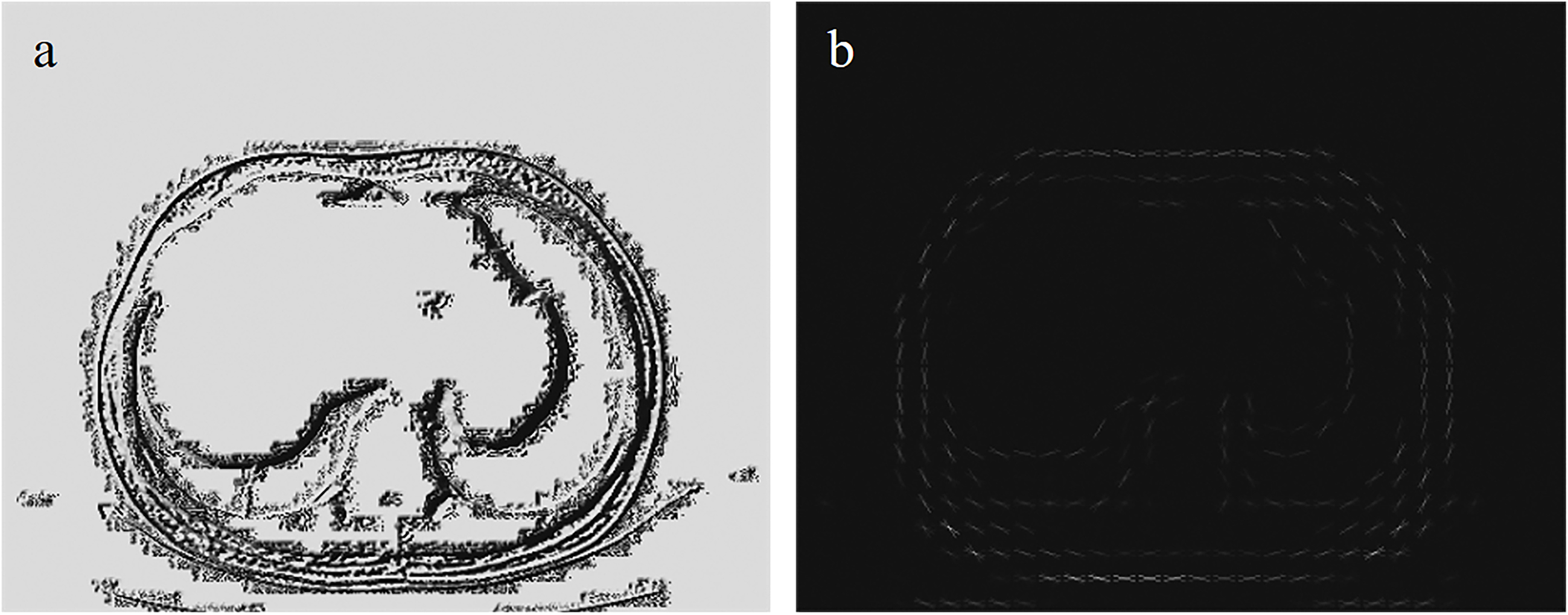 LBP feature and HOG feature. Figure (a) is the LBP feature extracted from the T11 layer CT image. Figure (b) is the HOG feature extracted from the T11 layer CT image.