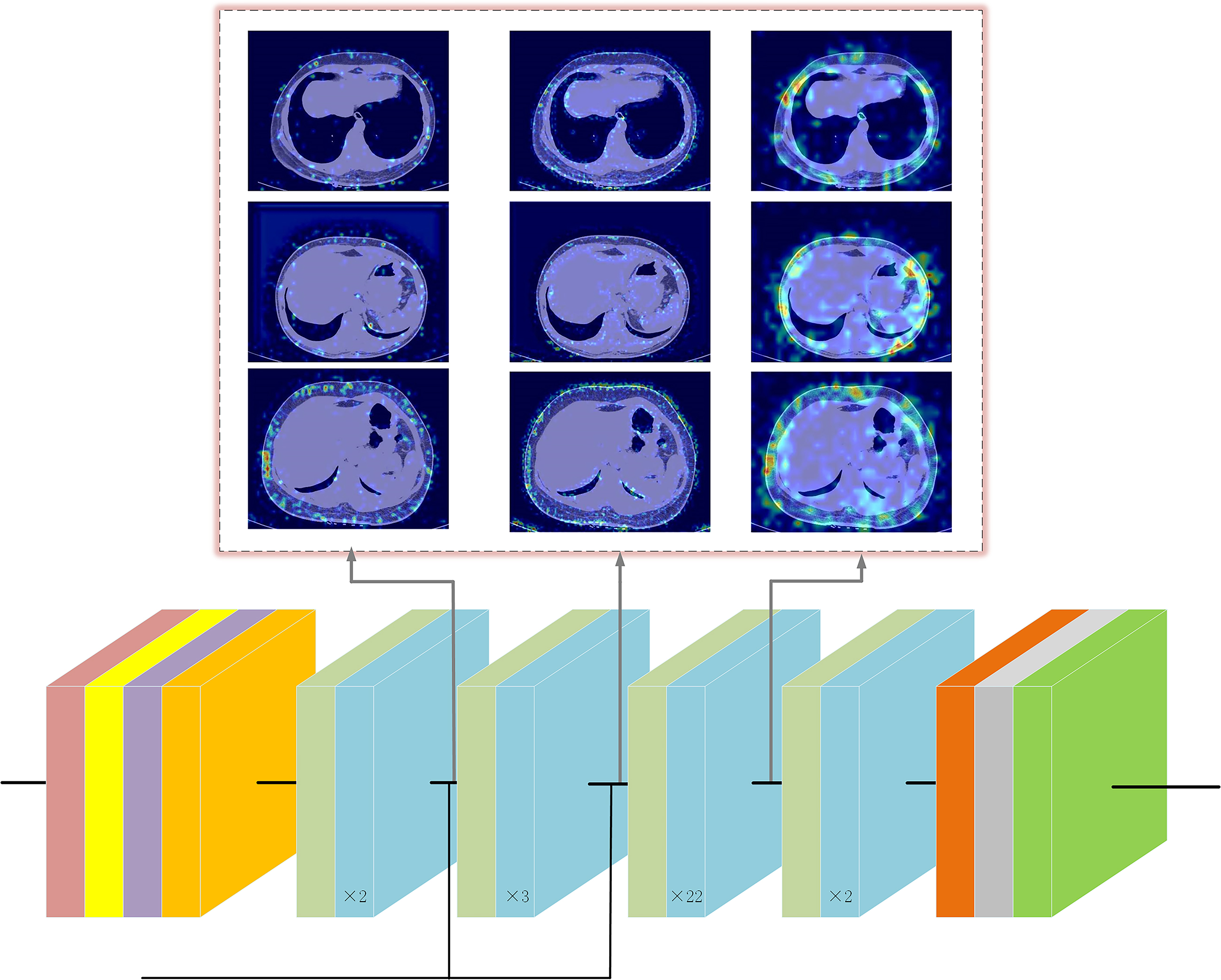 Responses of several convolutional layers in ResNet to CT images of different patients. Grad-CAM results of three CT images. Red areas represent a greater impact on the prediction, blue areas the opposite.