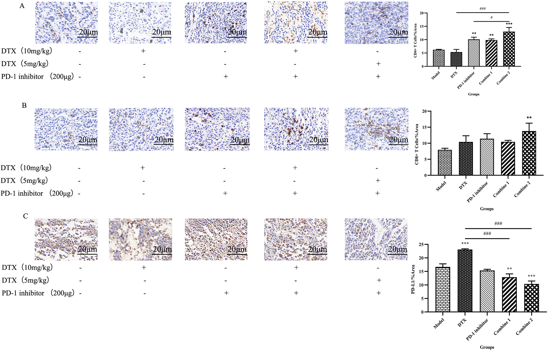 PD-l inhibitor combined with Docetaxel decreased tumor PD-LI expression and increases tumor-infiltrating CD4+ and CD8+T cells. (A) Tumors were harvested after mice being sacrificed and then fixed with 4% paraformaldehyde for 24 hours.The fixed tissues wereembedded in paraffin and cut into 4um thin sections on a paraffin microtomefor immunohistochemical experiments.After dewaxing, antigen repair, blocking endogenous peroxidase, serum sealing and PD-L1 antibody incubaticn, DAB chromogenic reaction, nucleus counterstaining, dehydration and moounting were performed. The prepared sections were examined under the microscope, and images were collected and analyzed by Image J.All the data were presented as means ± SD (n= 3). **P< 0.01; ***P< 0.001 (versus Model group, One-way ANOVA test followedby Tukey’s multiple comparisons test. (B) Following the procedure described above, CD4 antibodies were added during antibody incubation.The prepared sections were examined under the microscope, and images were collected and aralyzed by Image J. All the data were presented as means ± SD (n= 3). **P< 0.01; ***P< 0.001 (versus Model group, One-way ANOVA test followed by Tukey’s multiple comparisons test). #P< 0.05;###P< 0.01(versus Combine 2 group, One-way ANOVA test followed by Tukey’s multiple comparisons test). (C) Following the procedure described above, CD8 antibodies weree added during antibody incubation. The prepared sections were examined ulnder the microscope, and images were collected and analyzed by Image J. All the data were presented as means ± SD (n= 3). **P< 0.01(versus Model group, One-way ANOVA test followed by Tukey’s multiple comparisons test).
