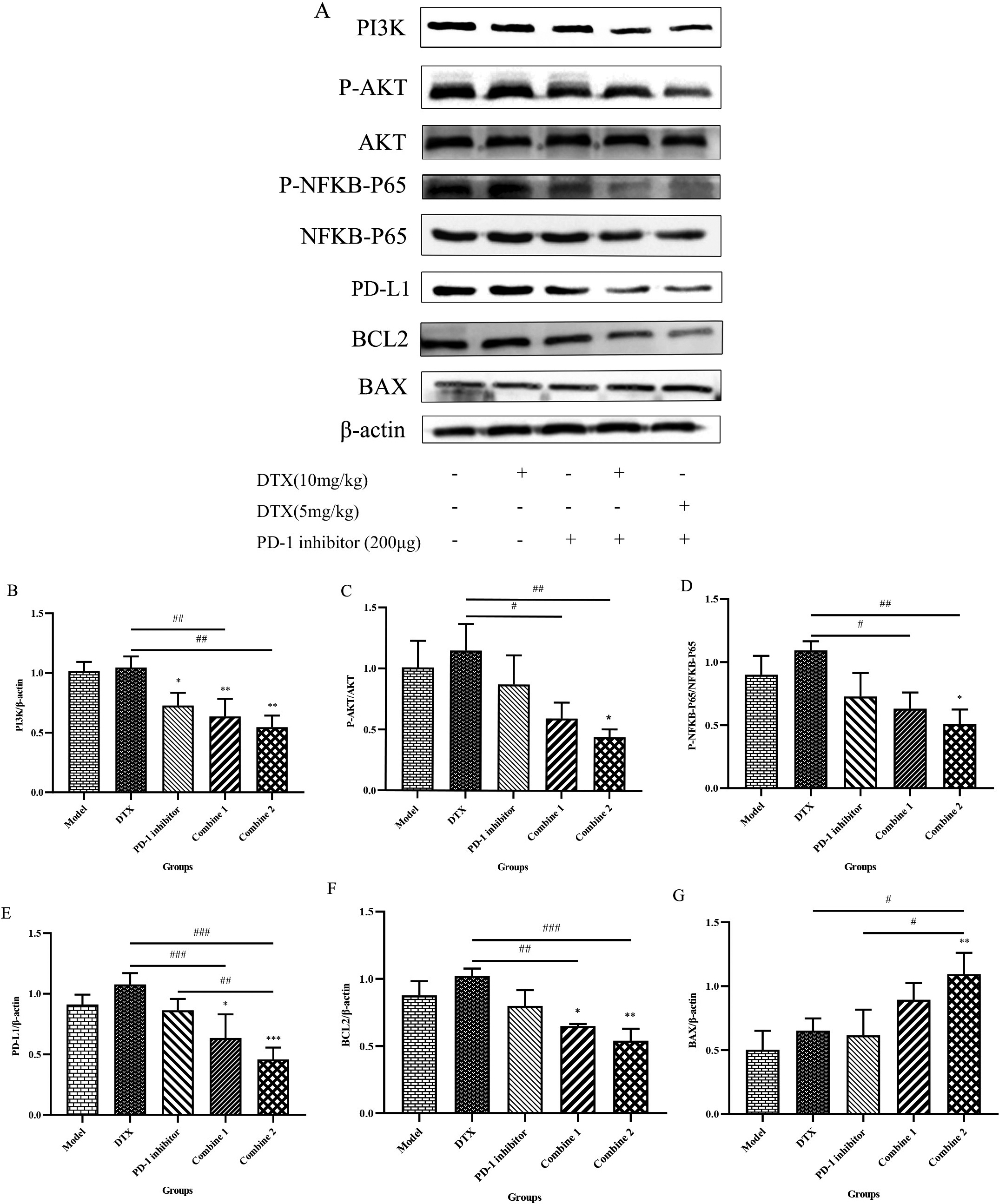 PD-1 inhibitor combined with Docetaxel exerted synergistic effects by inhibiting the NFKB-P65/PD-L1 signaling pathway. (A) Tumors were harvested after mice being sacrificed. The prepared protein samples were subjected to western blot in 10% separation gel and 5% concentrated gel, incubated overnight with Anti-PI3K, Anti-AKT, Anti-BCL2, Anti-BAX, Anti-NF-kB p65, Anti-P-NF-kB p65 Rabbit pAb and Anti-PD-L1 Rabbit pAb, and prtein bands were visualized with the AlphaImager HP gel imaging system. (B) The gels of PI3K and β-actin were analyzed with the Image J software (n= 3). *P< 0.05; **P< 0.01(versus Model group, One-way ANOVA test followed by Tukey’s multiple cormparisons test). ##P< 0.01 (versus DTX group, One-way ANOVA test followed by Tukey’s multiple comparisons test). (C) The gels of P-AKT and AKT were analyzed with the Image J software (n= 3). *P< 0.05; (versus Model group, One-way ANOVA test followed by Tukey’s multiple cormparisons test). #P< 0.05, ##P< 0.01, (versus DTX group, One-way ANOVA test followed by Tukey’s multiple comparisons test). (D) The gels of P-NFKB-P65 and NFKB-P65 were analyzed with the Image J software (n= 3). *P< 0.05 (versus Model group, One-way ANOVA test followed by Tukey’s multiple cormparisons test). #P< 0.05, ##P< 0.01 (versus DTX group, One-way ANOVA test followed by Tukey’s multiple comparisons test). (E) The gels of PD-L1 and β-actin were analyzed with the Image J software (n= 3). *P< 0.05; ***P< 0.001(versus Model group, One-way ANOVA test followed by Tukey’s multiple cormparisons test). ##P< 0.01 (PD-1 inhibitor group versus Combine 2 group, One-way ANOVA test followed by Tukey’s multiple comparisons test); ###P< 0.001 (versus DTX group, One-way ANOVA test followed by Tukey’s multiple comparisons test). (F) The gels of BCL2 and β-actin were analyzed with the Image J software (n= 3). *P< 0.05; **P< 0.01 (versus Model group, One-way ANOVA test followed by Tukey’s multiple cormparisons test). ##P< 0.01, ###P< 0.001 (versus DTX group, One-way ANOVA test followed by Tukey’s multiple comparisons test). (G)The gels of BAX and β-actin were analyzed with the Image J software (n= 3). **P< 0.05 (versus Model group, One-way ANOVA test followed by Tukey’s multiple cormparisons test). #P< 0.05 (versus Combine 2 group, One-way ANOVA test followed by Tukey’s multiple comparisons test). 