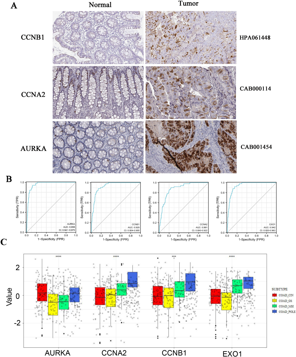 The protein expression of Hub genes were up-regulated in colorectal cancer. A, HPA database was used to analyzed the protein expression of AURKA, CCNB1 and CCNA2 in normal and tumor tissue by immunohistochemistry. B, ROC curves of AURKA, CCNB1, EXO1 and CCNA2 were obtained from online tool Xiantao Academy. C, The differences of gene expression among four subtypes of colorectal cancer (POLE, MSI, CIN and GS) were investigated using R software.