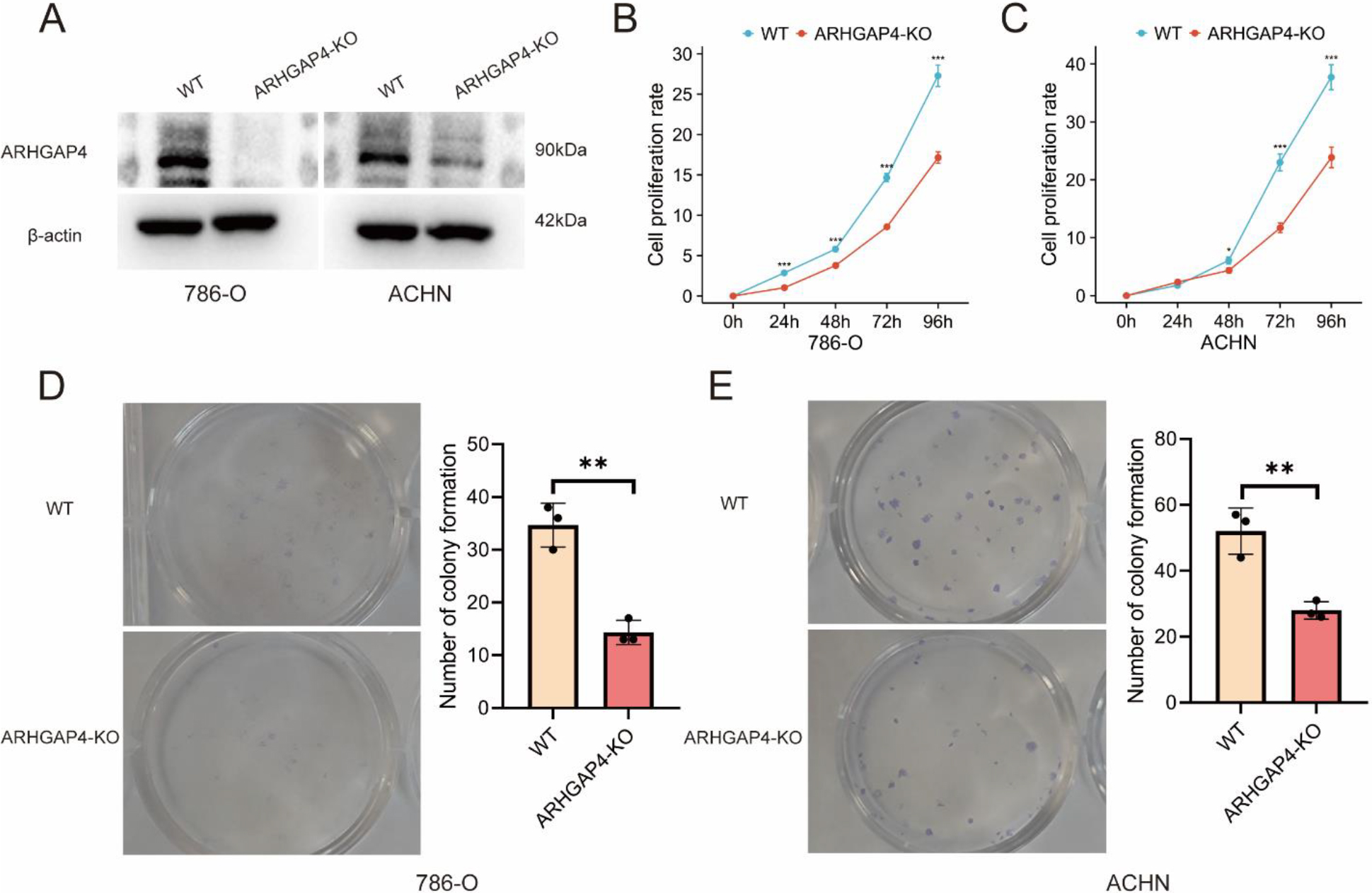 Verification of the effect of ARHGAP4 on growth and proliferation in vitro. (A) Expression of ARHGAP4 protein in 786-O and ACHN cells in control group and ARHGAP4-KO group. (B, C) Cell proliferation rate of control group and ARHGAP4-KO group in 786-O and ACHN cells. (D, E) Number of colonies in control group and ARHGAP4-KO group in 786-O and ACHN cells. **p < 0.01; ***p < 0.001.