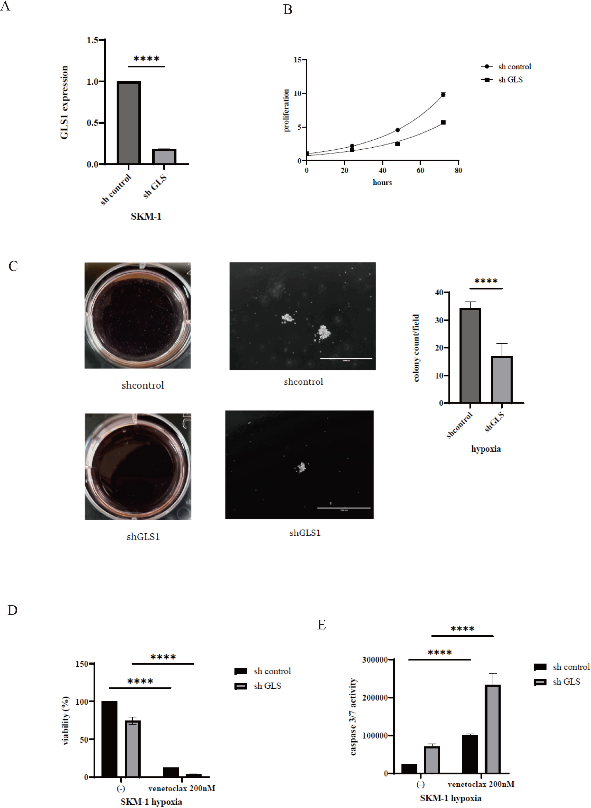 Knockdown of GLS1-induced venetoclax activity under hypoxia. (A) Gene expression of GLS1 was analyzed by RT-PCR assay. **** p< 0.0001 were compared to control shRNA transfectant cells. (B) Cellular proliferation of shRNA-transfected SKM-1 cells was evaluated using the CellTiter-Glo™ Luminescent Cell Viability Assay Kit or Cell Counting Kit-8. (C) 1 × 102 shRNA transfectant SKM-1 cells were plated under hypoxia for 7 days. The colonies on each dish were photographed using a digital camera and counted using an EVOS™ FL Digital Inverted Fluorescence Microscope. The quantitative graph displays the colonies formed, and representative images are shown. Scale bar: 1,000 μm. **** p< 0.0001 were compared to control shRNA transfectant cells. The results represent three independent experiments. (D, E) ShRNA transfectant SKM-1 cells were incubated with the indicated concentration of venetoclax with or without hypoxia for 48 or 72 h. Cell viability (D) and caspase 3/7 activity (E) were evaluated. **** p< 0.0001 were compared to control.