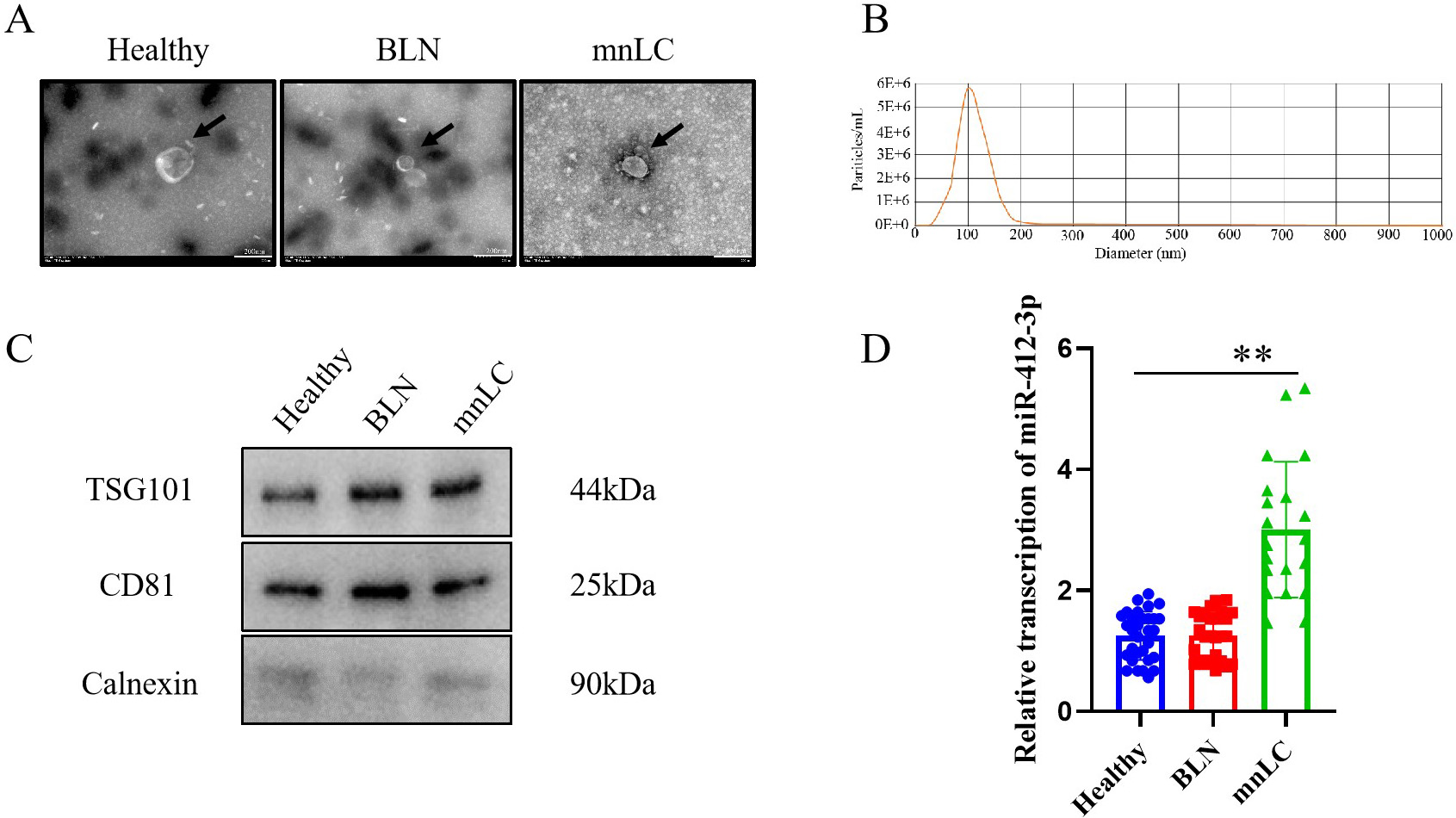 Morphological characteristics and particle size distribution of sEVs in patients with sub-centimeter pulmonary nodules, as well as the expression level of miR-412-3p in sEVs. (A) TEM observation of the morphological characteristics of sEVs; (B) Evaluation of sEVs particle size distribution using nanoparticle size analysis method; (C) Surface positive markers (TSG101 and CD81) and negative markers (calnexin) protein bands of sEVs; (D) RT-qPCR was used to detect the transcription level of miR-412-3p in sEVs. ** P< 0.01, compared to the BLN and Healthy groups. All the results are representative of three independent experiments.