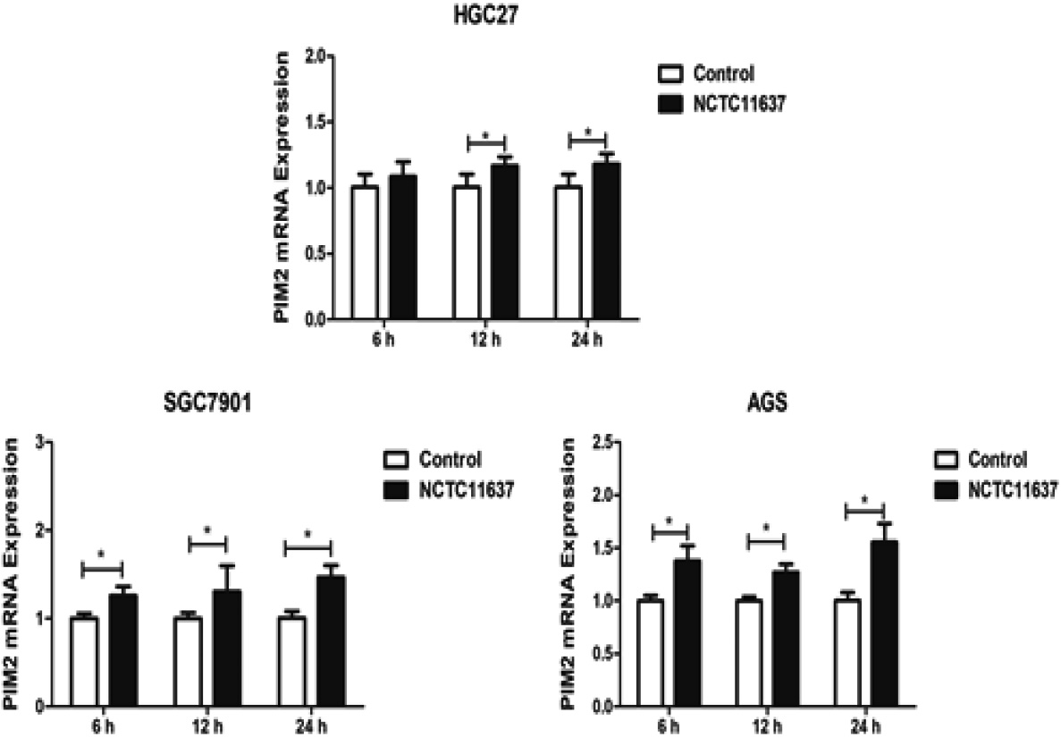 The expression of PIM2 mRNA in H. pylori NCTC11637-infected HGC27, SGC7901, and AGS cells at 6 h, 12 h, and 24 h post-infection (*P< 0.05).