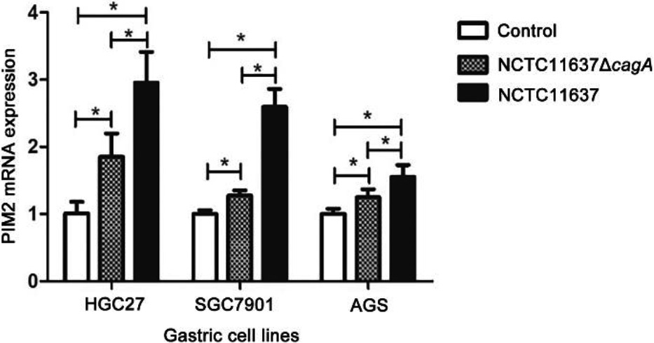 Expression of PIM2 mRNA in the GC cells co-cultured with H. pylori (cagA+) and H. pylori (ΔcagA), respectively (*P< 0.05).