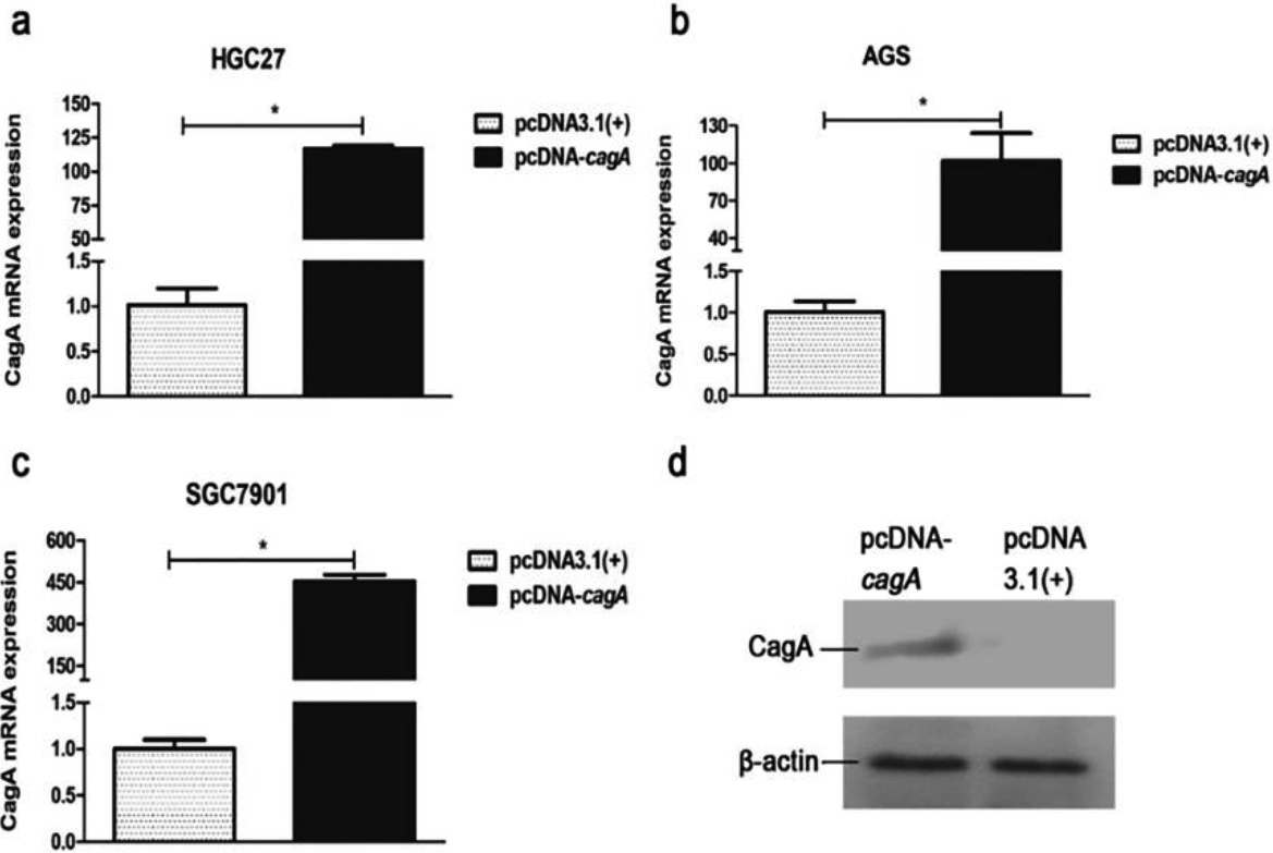 Expression of cagA gene in the GC cells transfected with pcDNA-cagA plasmid. (a) (b) (c) CagA mRNA expression in the GC cells, HGC27, AGS and SGC7901, transfected with pcDNA-cagA and pcDNA3.1(+), respectively, for 48 h; (d) Expression of CagA in the SGC7901 cells transfected with pcDNA-cagA for 48 h (*P< 0.05).