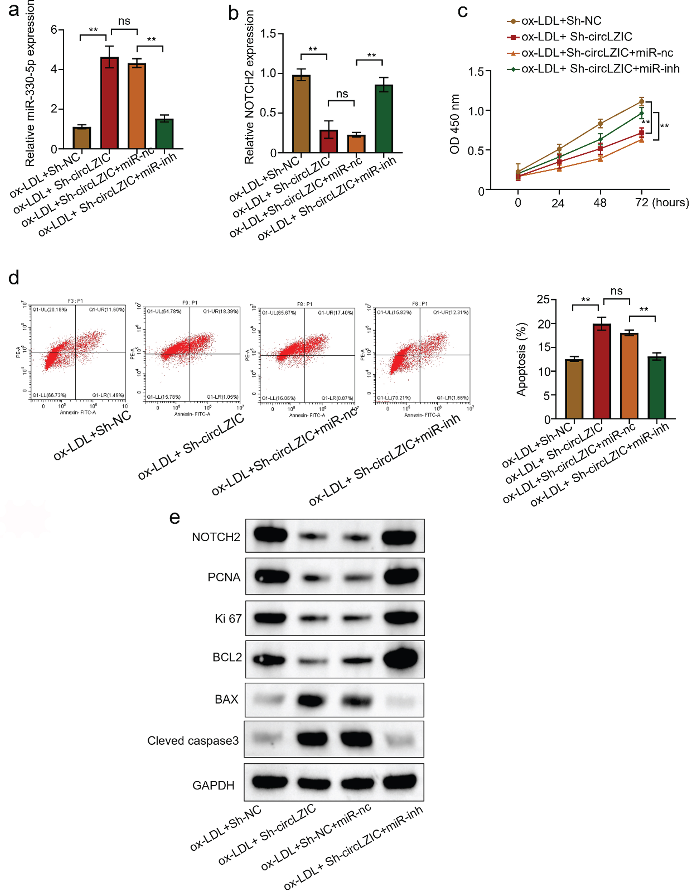 
CircLZIC regulates ox-LDL-induced vascular endothelial cell proliferation and apoptosis via Micro-330-5p/NOTCH2 axis. (A) qRT PCR was used to detect the expression of Micro-330-5p in different groups. (B) qRT PCR was used to detect the expression of NOTCH2 in different groups. (C) CCK-8 detected the changes in the activity of HUVECS cells in different groups. (D) Flow cytometry apoptosis assay was used to detect the changes in the proportion of HUVECs undergoing apoptosis in different groups. (E) Western blot was used to detect the expression of proliferation- and apoptosis-related proteins in different groups of HUVECs.