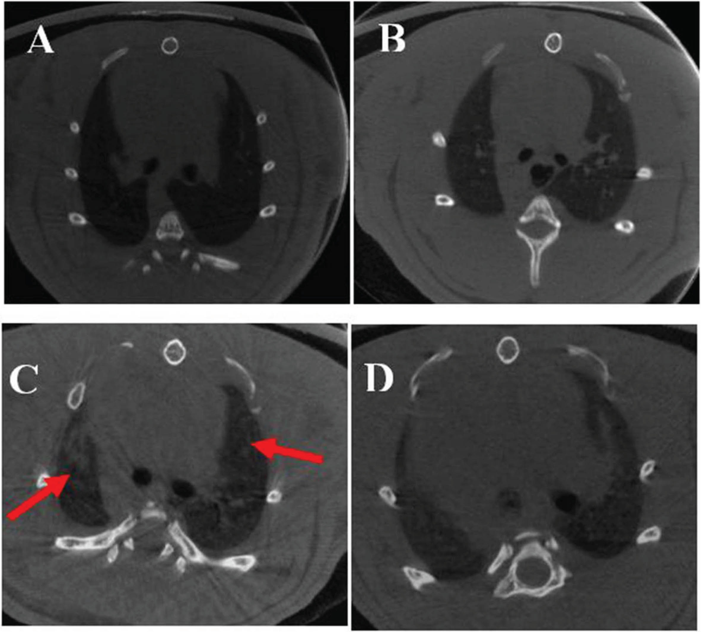 Micro-CT images of rats in each group. A: CON group; B: CON + Parkin group; C: EHS group; D: HS + Parkin group red arrow: patchy exudation.