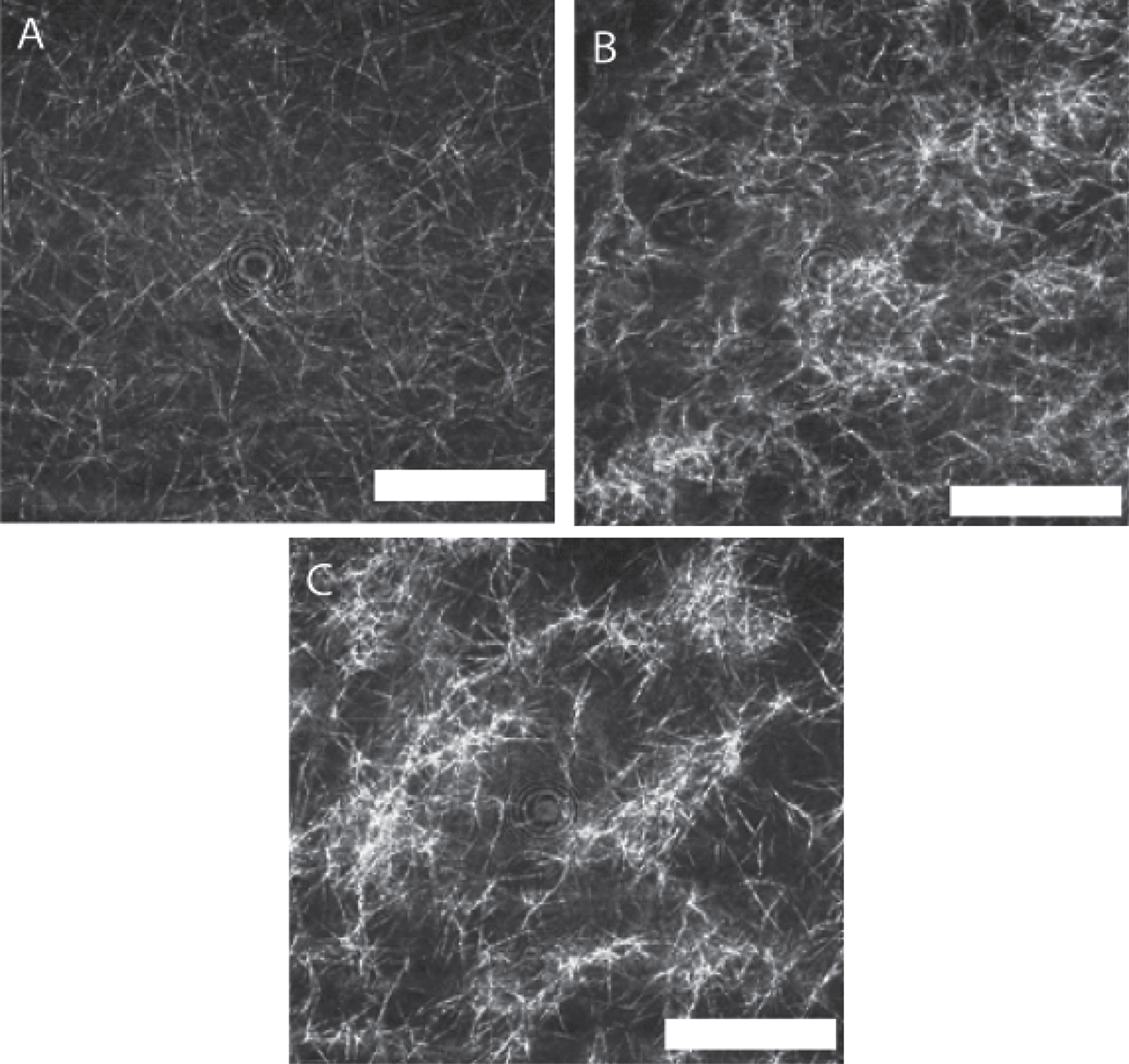 LSCM images of a fibrin gel formed under SAOS and those formed under CSPS at three different levels of shear stress. Fibrin gel network formed under (A) SAOS (σs= 0 Pa), (B) CSPS (σs= 0.1 Pa) and (C) CSPS (σs= 0.35 Pa) with the corresponding values of df being 1.99 (± 0.01), 2.03 (± 0.01) and 2.3 (± 0.05), respectively. The images were acquired immediately following the attainment of the GP in the rheometer. The scale bar width is 20 μm.