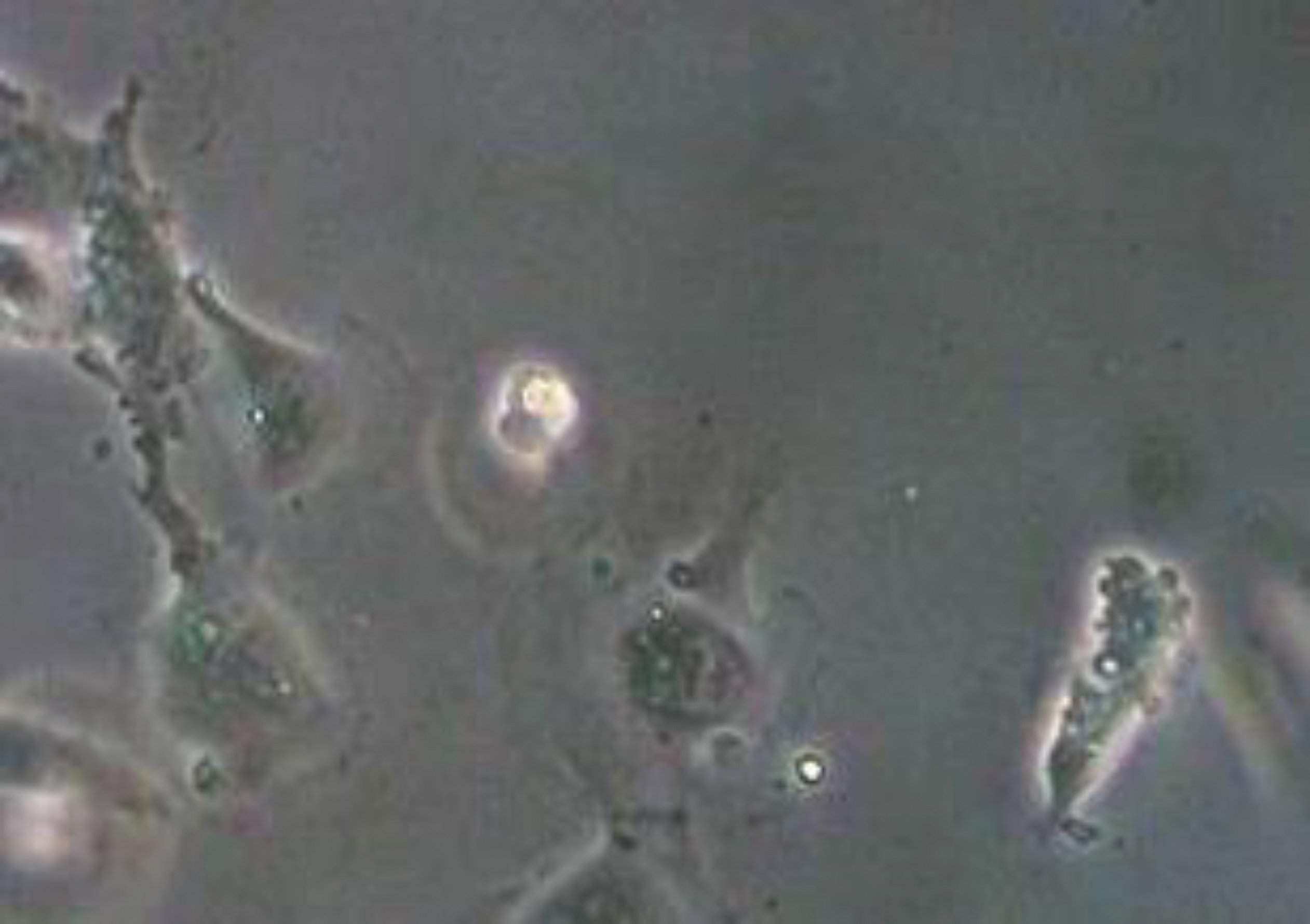 Apoptotic endothelial cells with signs of blebbing and detached microvesicles (cLSM, objective ×40).
