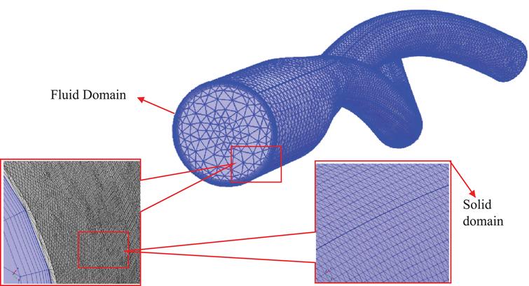 Mesh generated for the CFD evaluation of the ballet-type model. Tetrahedral mesh was generated for the fluid and solid domains, and hexahedral boundary layers were used near the boundary wall of fluid domain.