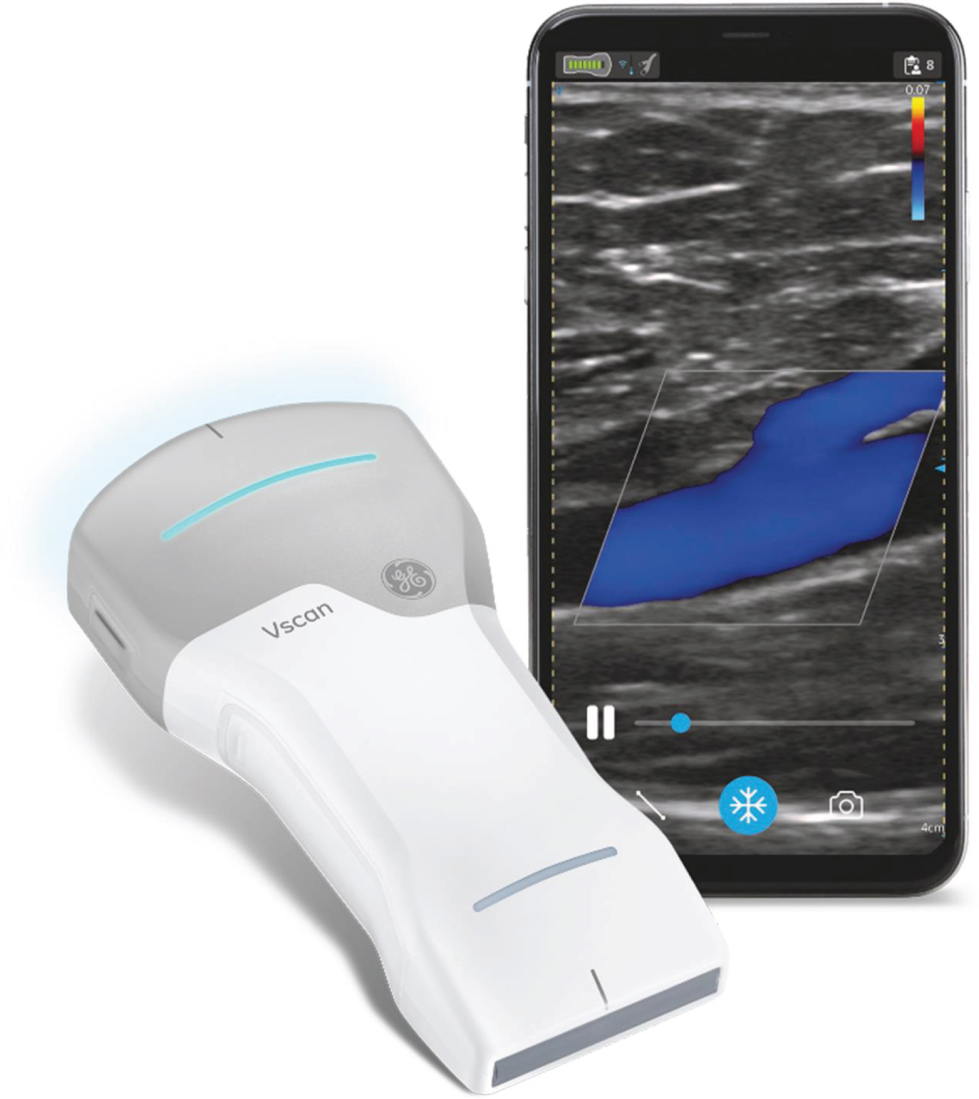 Image of the wireless point-of care ultrasound device (Vscan Air, GE Healthcare, USA) with kind permission of Mr Benjamin Preissler (GE Healthcare).