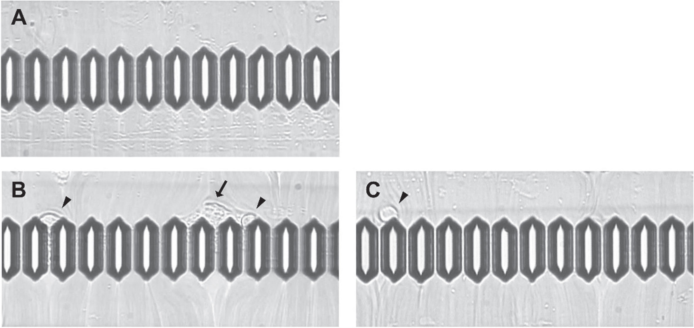 Micrographs of blood flow. Flow channel images (A) before exercise with 0 mM of L-arginine, (B) after exercise without L-arginine, and (C) after exercise with 1 mM of L-arginine. Arrow indicates aggregated platelets; arrowhead indicates adherent white blood cells.