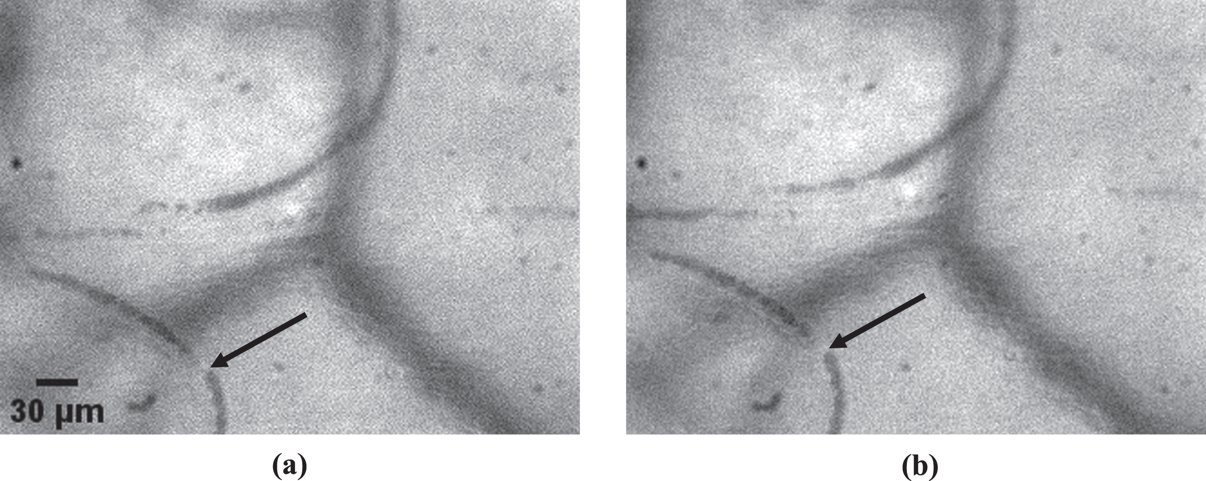 An example of an occluded microvessel (black arrow). Two images of the same microvessel were taken at different instances. It is clear that, even though image (a) was taken 146 ms earlier than image (b), the red blood cell column has not advanced and that blood flow has stopped.