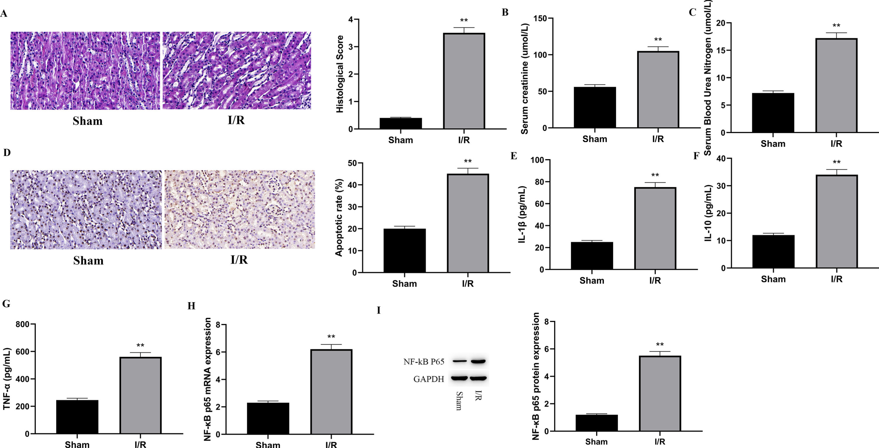 Following I/R injury, NF-kB p65 was shown to be strongly expressed in the renal tissues of rats.