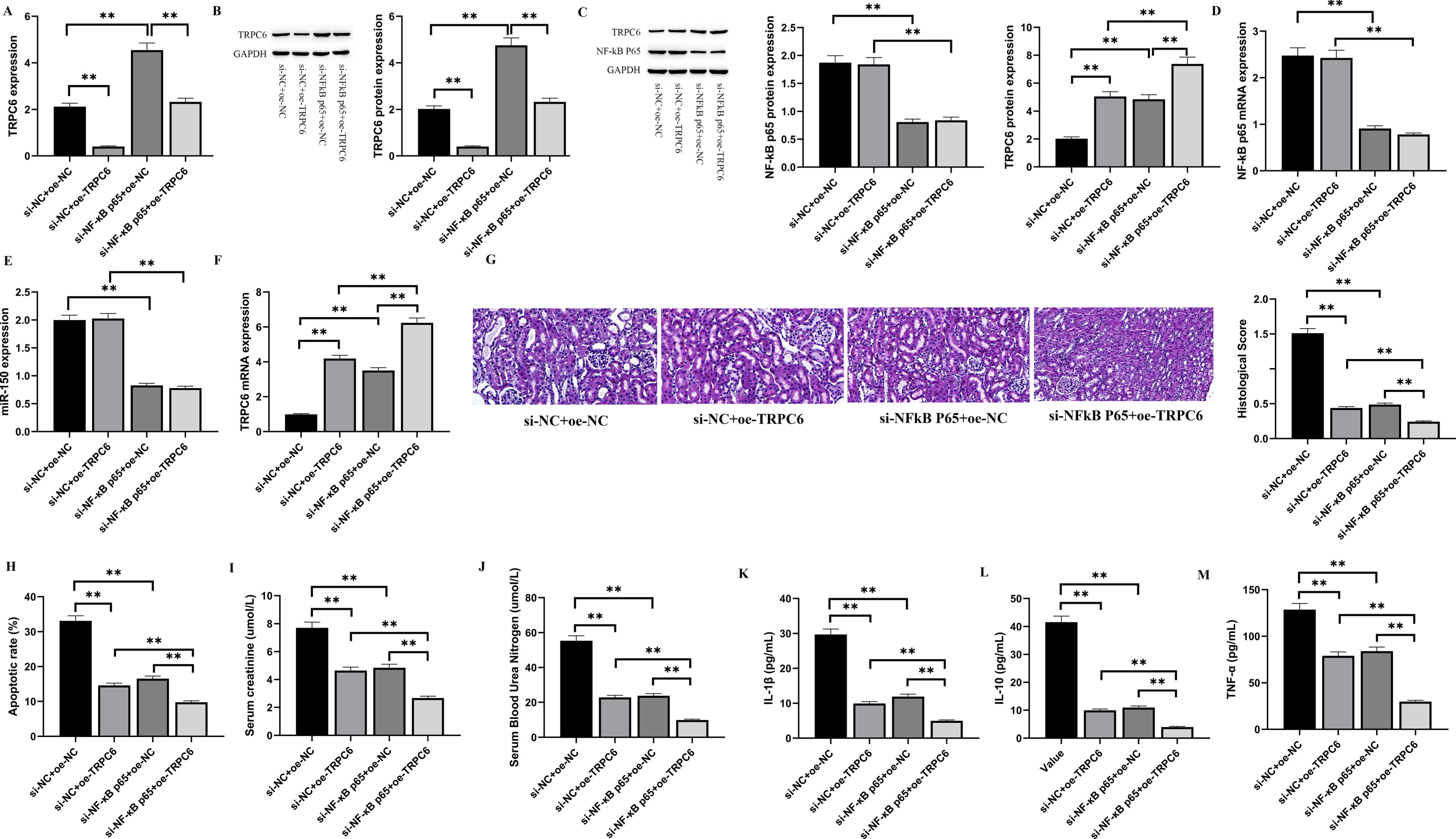 NF-kB p65 promotes renal I/R injury in rats by inhibiting TRPC6 expression via miR-150.