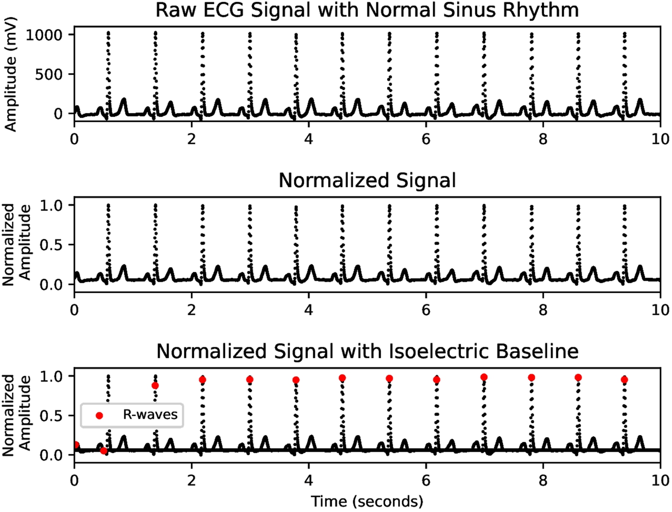 Depiction of preprocessing transformations applied to a normal sinus rhythm ECG signal. A) raw ECG signal with normal sinus rhythm. B) normalized ECG signal with maximum amplitude 1 and minimum amplitude 0. C) normalized ECG signal with isoelectric baseline included and R-waves identified.