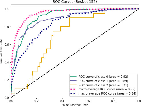 ROC curves for ResNet152.