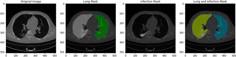 Images when loaded to preview of original image, lung mask, infection mask and lung and infection mask.