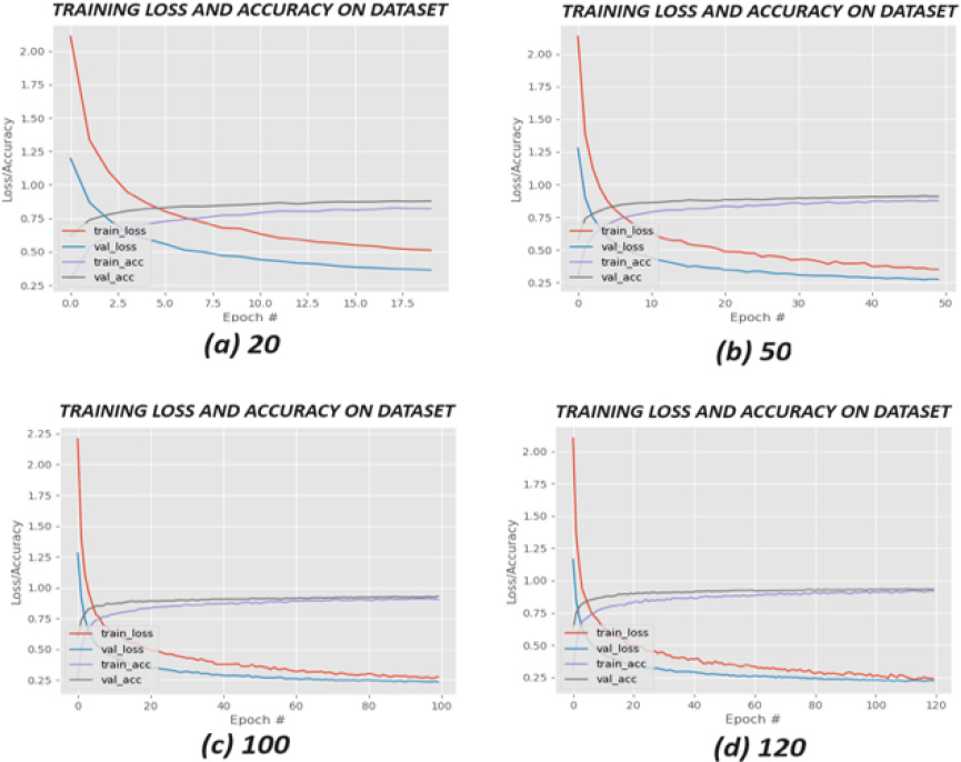 Comparison of learning curves for training and validation loss and accuracy on a dataset, with incremental epochs of 20, 50, 100, and 120.