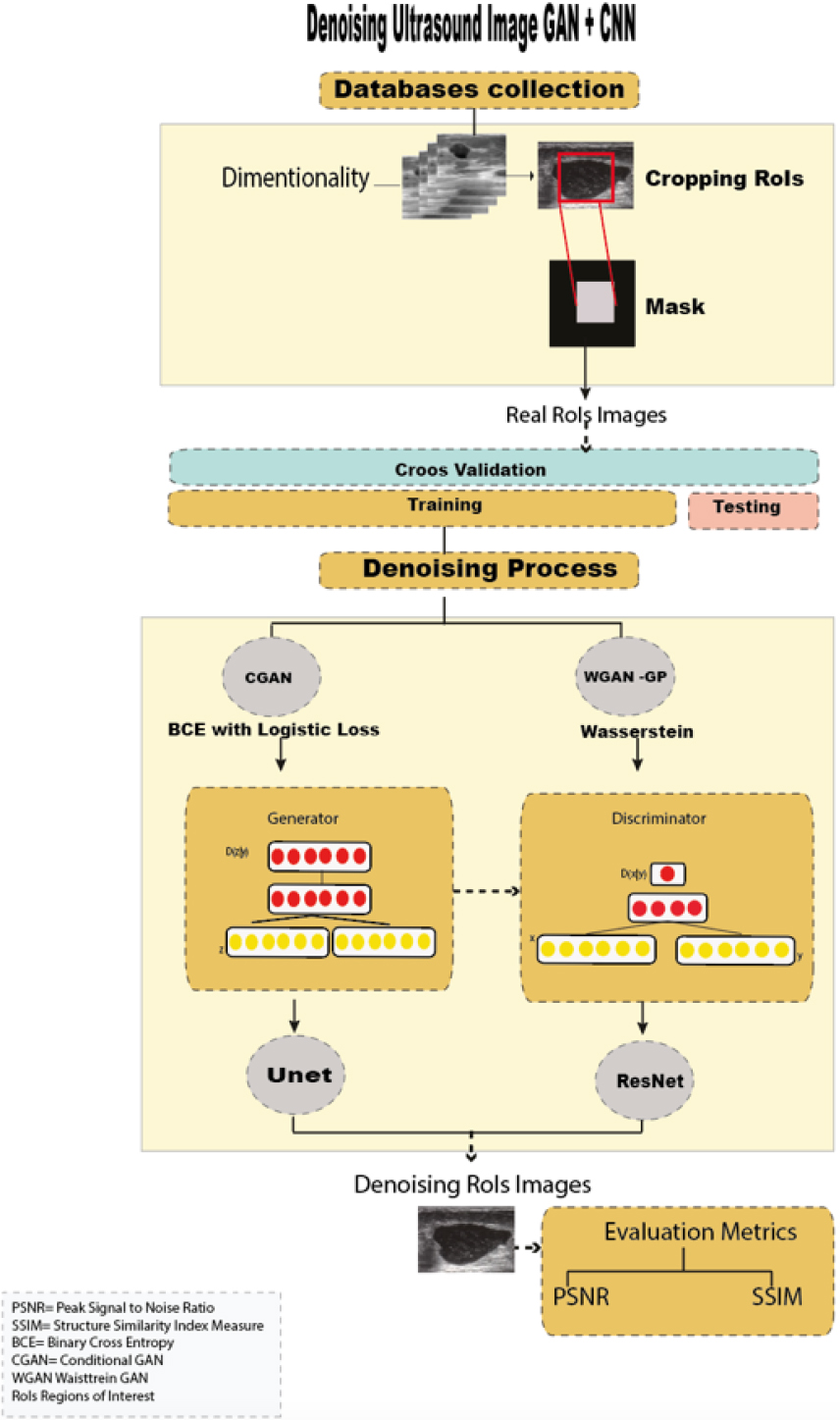 Workflow of GANs+CNN models implementation in breast ultrasound denoising.