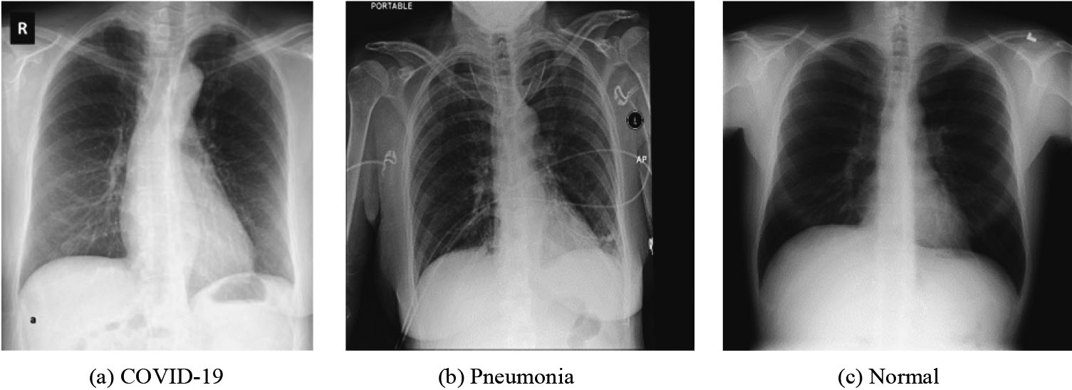 Sample image of each class: (a) COVID-19, (b) Pneumonia and (c) Normal.