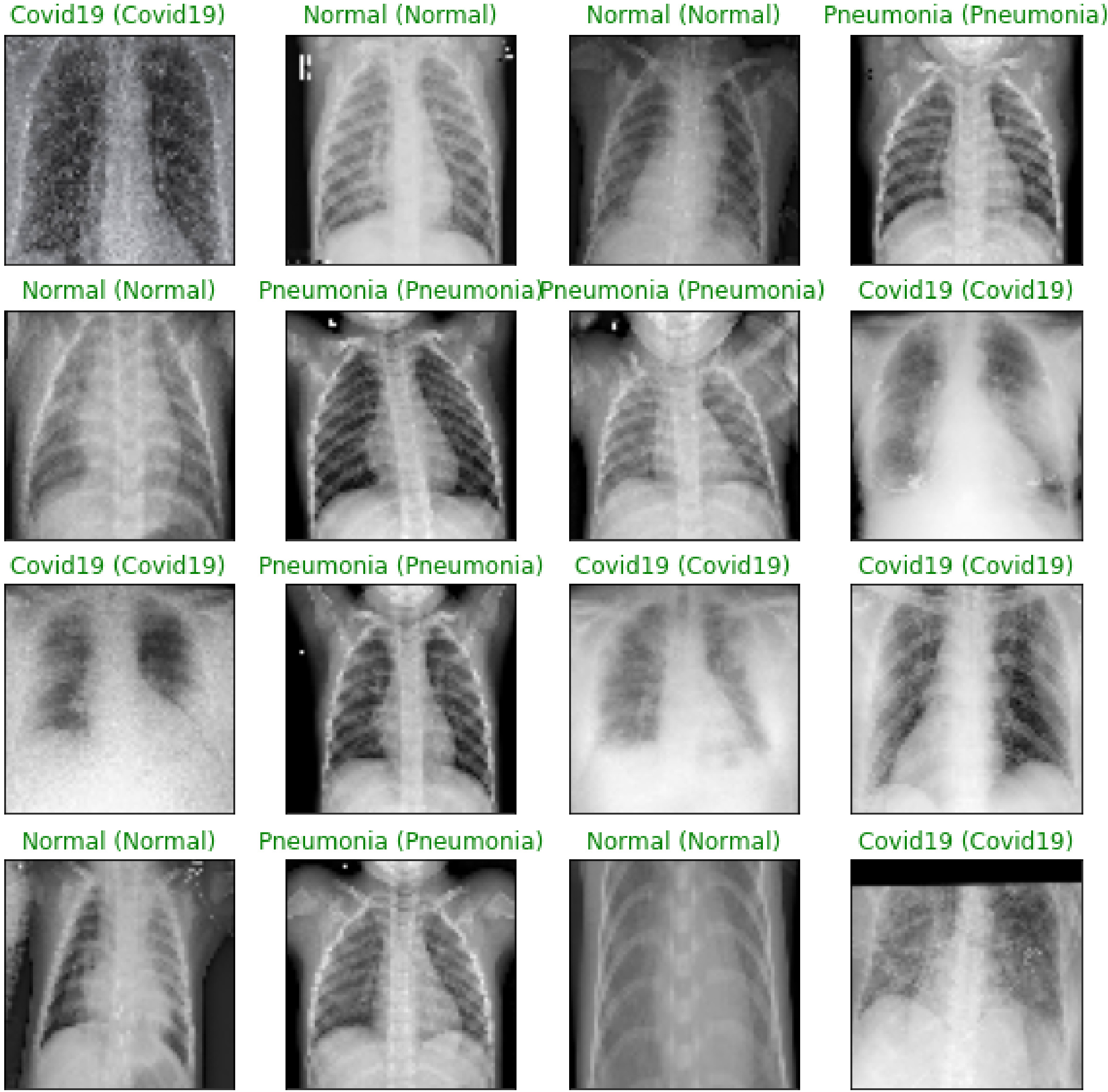 Predicted X-ray images using VGG-19 model.