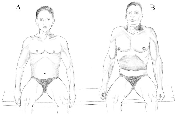 Breathing stereotype test. A. Optimal pattern. Spine upright, trunk in neutral position, relaxed auxiliary breathing muscles, proportional expansion of abdominal wall occurs with inhalation. B. Pathological stereotype. The chest moves superiorly, shoulders moves superiorly and into protraction during inhalation, insufficient or no expansion of the abdominal wall.