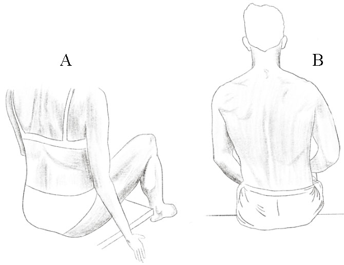 Hip flexion test. A. Optimal pattern. Chest and pelvis in neutral position, spine upright. B. Pathological stereotype. Inability to keep the spine upright and pelvis stable, lateral shift of the trunk.