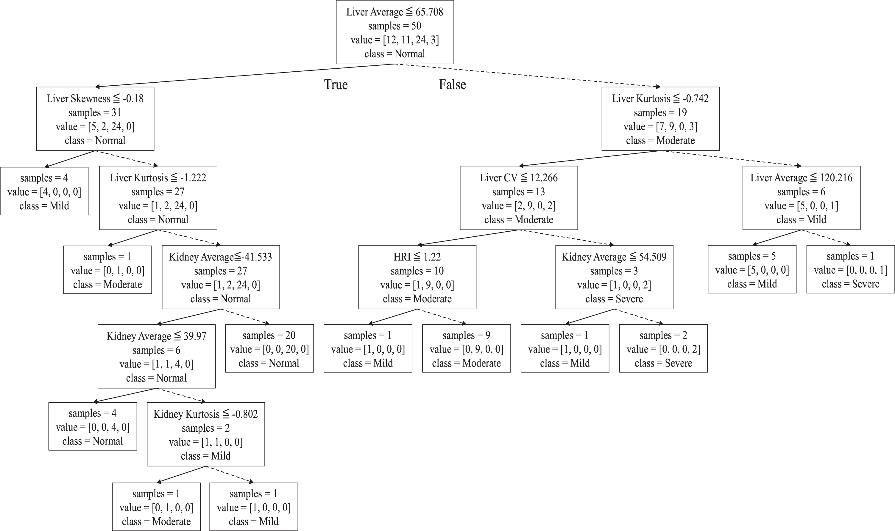 Decision tree to decide fatty liver severity classification.