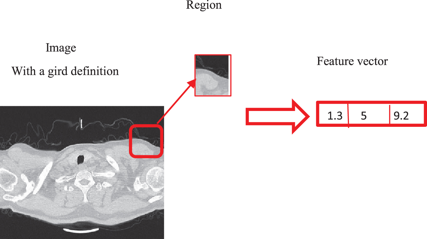 The general example for feature extraction of CT scan image.