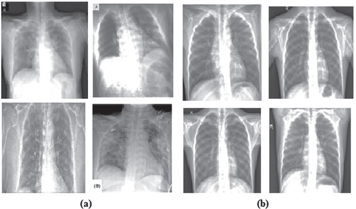 (a) positive (i.e., infected) COVID-19 X-ray images (b) negative samples.