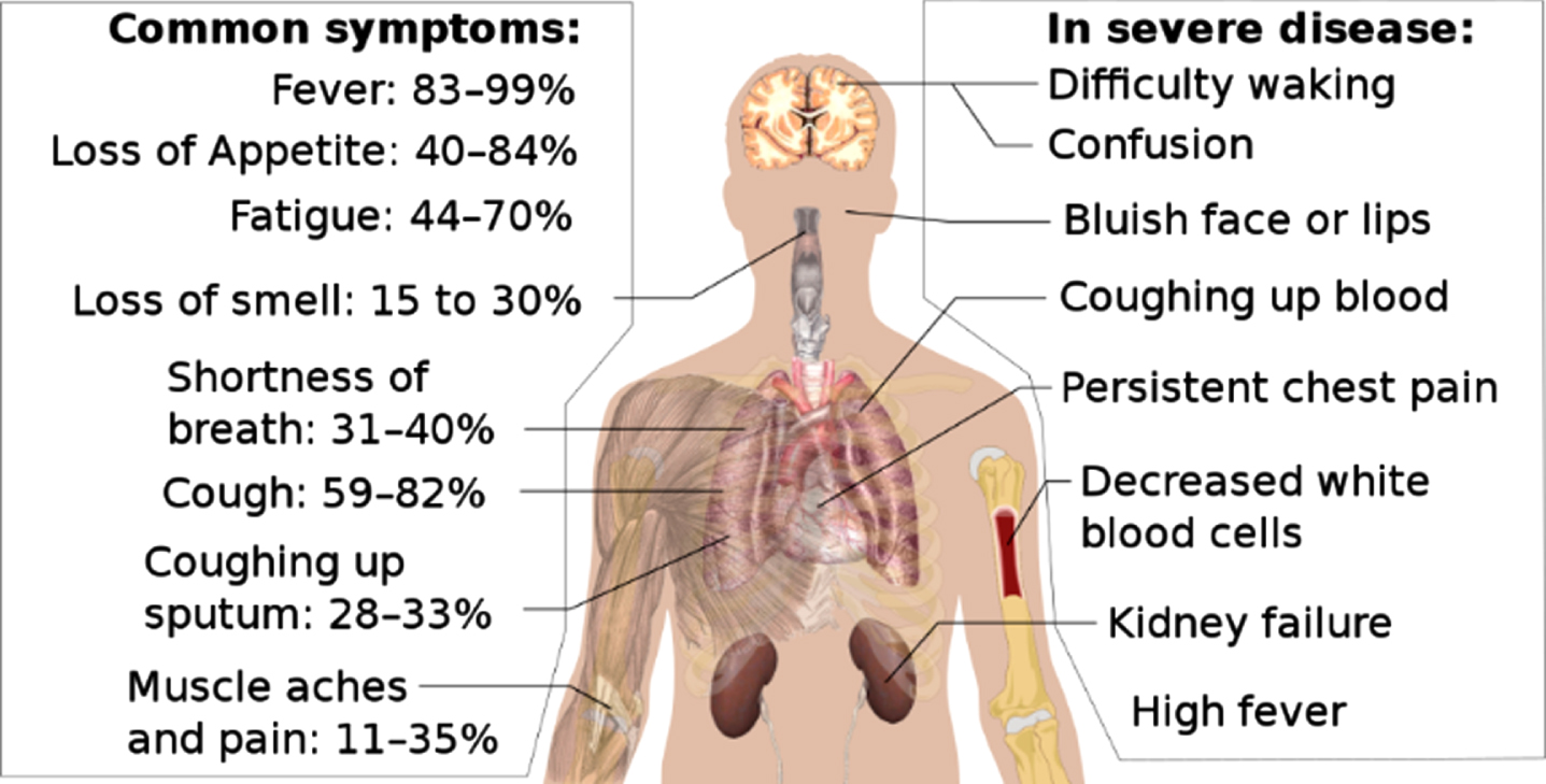 Common Symptoms for COVID-19. [39].