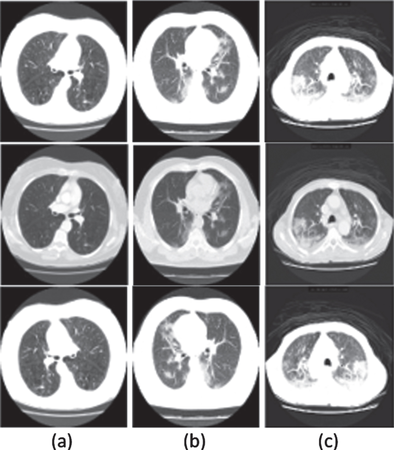 Sample examples from COVID-19 CT image Dataset. (a) Healthy lung (b) COVID-19 infected lungs (c) Pneumonia infected lungs. [41].