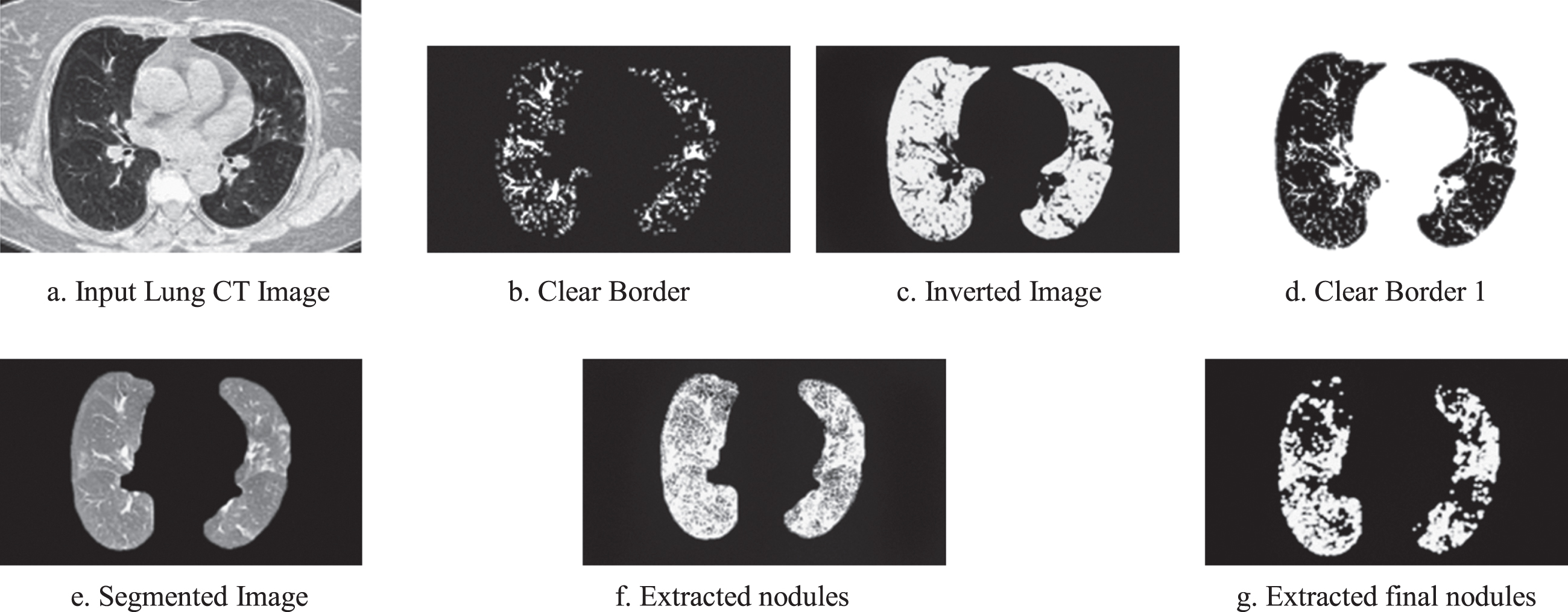 a–2 g. Experimental images obtained for Pulmonary Edema.