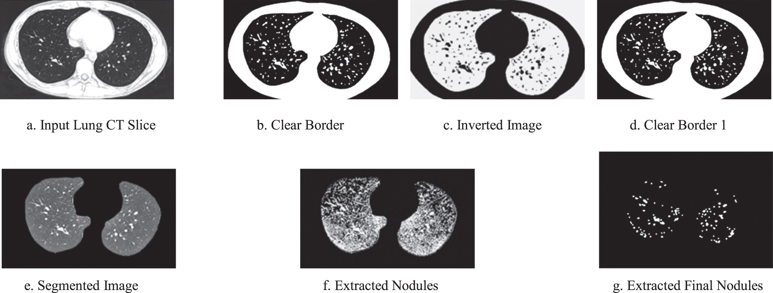 a –3 g. Experimental images obtained for Normal Lung Slices.