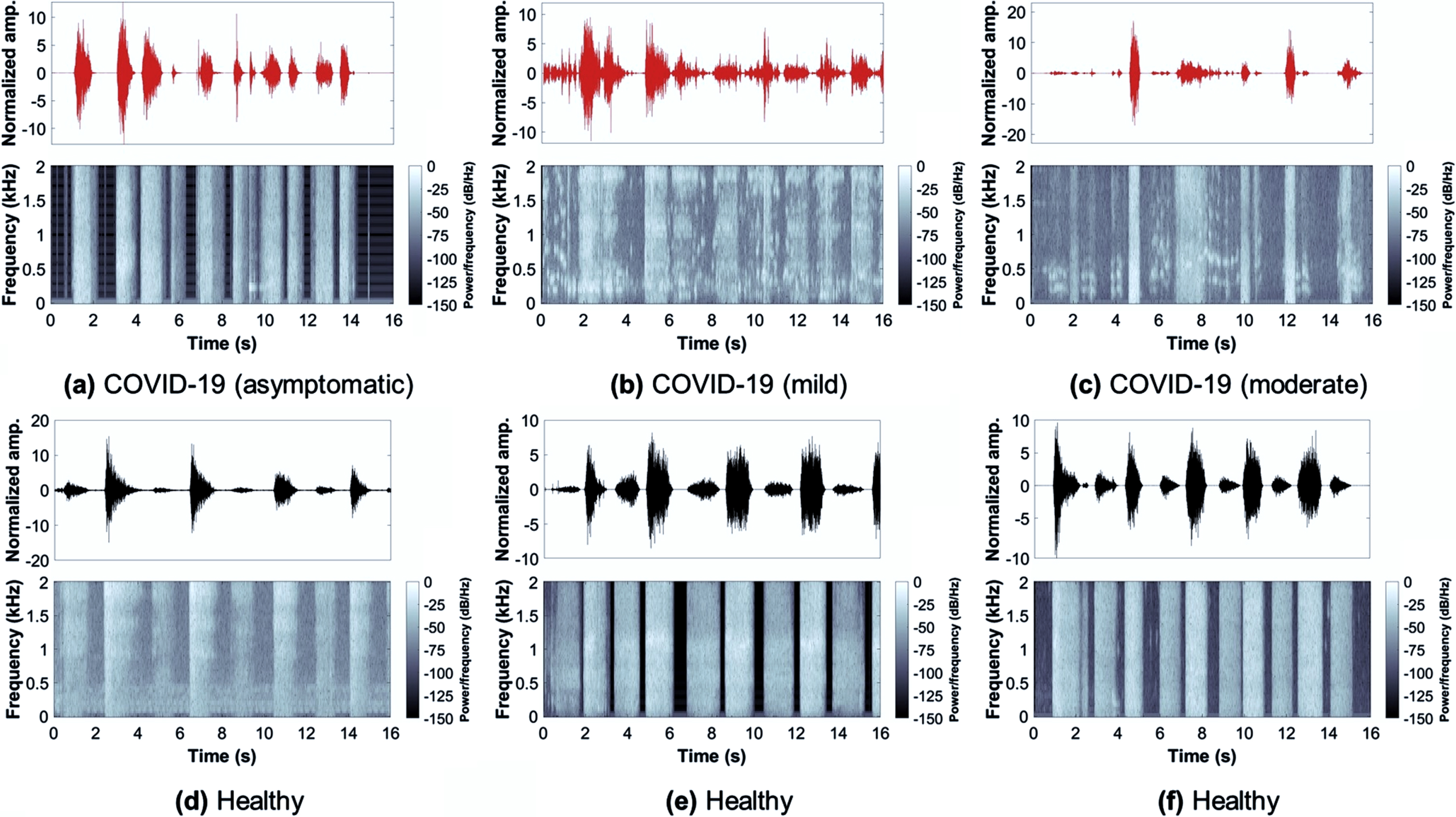 Corresponding spectrograms detect breathing sounds form the real-time virus database.