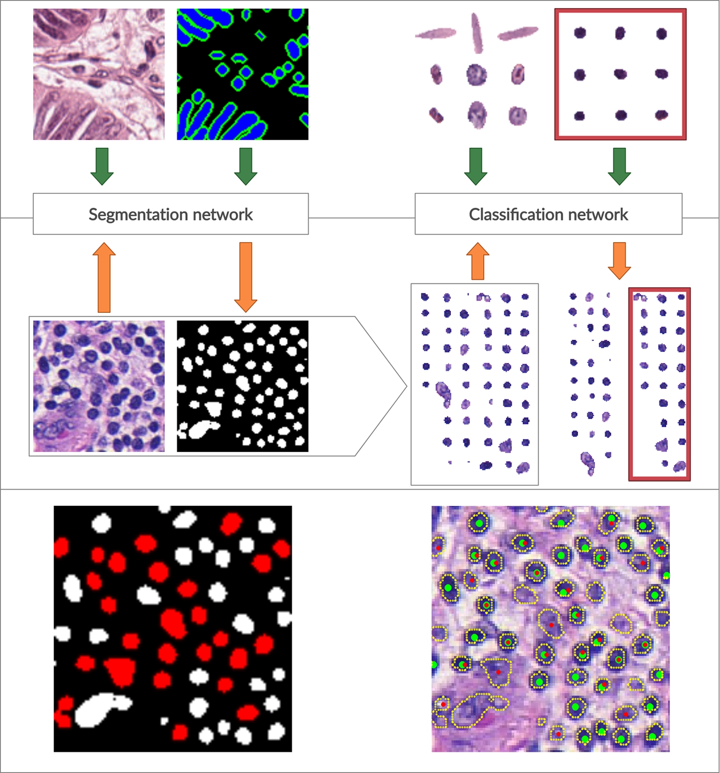Overall schema of the proposed workflow. On top, a training phase for both segmentation and classification models is shown. The segmentation network is trained on original image patches and manually annotated ground truth images. The classification model is trained on cropped nuclei to discriminate lymphocytes (in the red box) from other nuclei. In the middle, a testing phase is shown. The trained segmentation model accepts new images and produces segmentation masks (for clarity, the active contour layer in the resulting segmentation mask is not shown). Resulting segmentation masks are used to crop out detected cell nuclei that are fed into the classifier model and sorted into lymphocytes and non-lymphocyte nuclei. In the bottom panel, on the left, we have representative segmentation results (lymphocyte nuclei are coloured in red for clarity), and on the right, we have an original image with detected nuclei contours outlined and detected lymphocyte nuclei depicted with red dots. Green dots indicate lymphocyte ground truth.